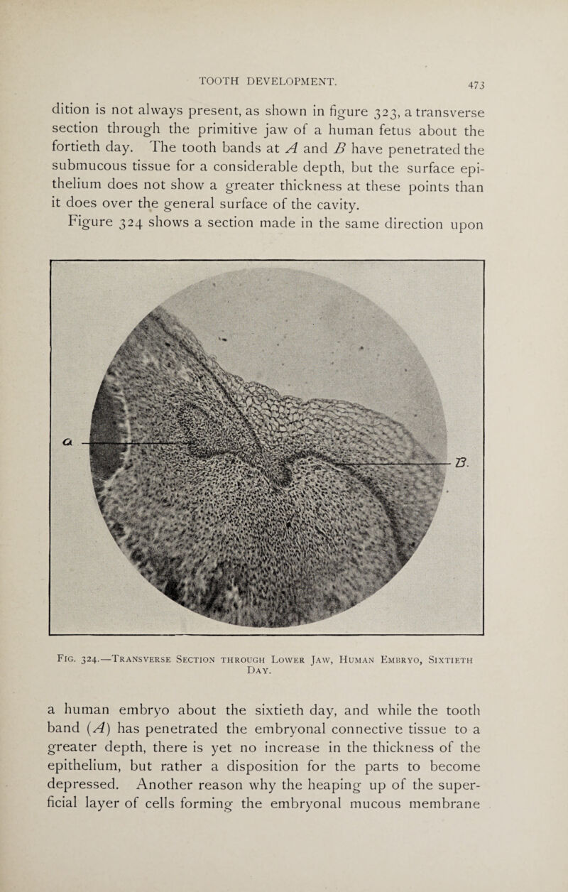 473 dition is not always present, as shown in figure 323, a transverse section through the primitive jaw of a human fetus about the fortieth clay. The tooth bands at A and B have penetrated the submucous tissue for a considerable depth, but the surface epi¬ thelium does not show a greater thickness at these points than it does over the general surface of the cavity. Figure 324 shows a section made in the same direction upon Fig. 324.—Transverse Section through Lower Jaw, Human Embryo, Sixtieth Day. a human embryo about the sixtieth day, and while the tooth band (A) has penetrated the embryonal connective tissue to a greater depth, there is yet no increase in the thickness of the epithelium, but rather a disposition for the parts to become depressed. Another reason why the heaping up of the super¬ ficial layer of cells forming the embryonal mucous membrane