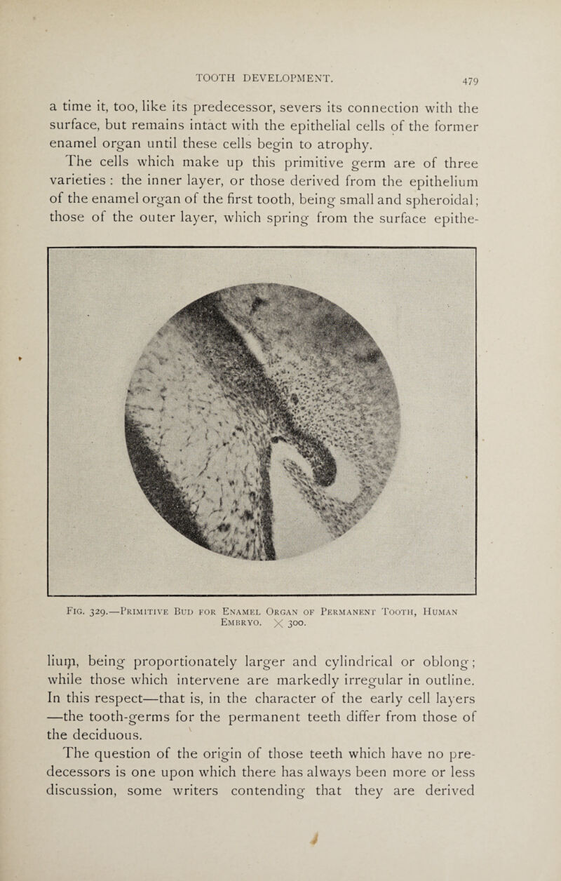 a time it, too, like its predecessor, severs its connection with the surface, but remains intact with the epithelial cells of the former enamel organ until these cells begin to atrophy. The cells which make up this primitive germ are of three varieties : the inner layer, or those derived from the epithelium of the enamel organ of the first tooth, being small and spheroidal; those of the outer layer, which spring from the surface epithe- Fig. 329.—Primitive Bud for Enamel Organ of Permanent Tooth, Human Embryo. X 3°°- liuip, being proportionately larger and cylindrical or oblong; while those which intervene are markedly irregular in outline. In this respect—that is, in the character of the early cell layers —the tooth-germs for the permanent teeth differ from those of the deciduous. The question of the origin of those teeth which have no pre¬ decessors is one upon which there has always been more or less discussion, some writers contending that they are derived