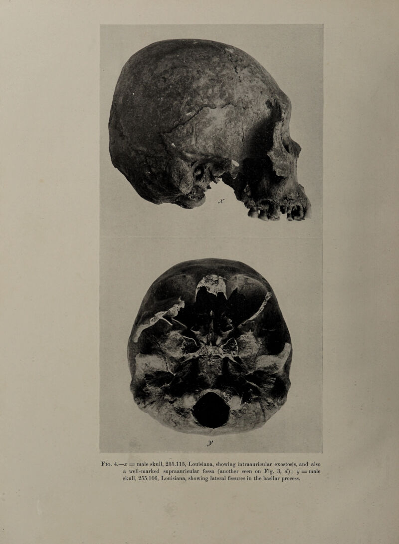 Fig. 4.—x — male skull, 255.115, Louisiana, showing intraauricular exostosis, and also a well-marked supraauricular fossa (another seen on Fig. 3, d) ; y — male skull, 255.106, Louisiana, showing lateral fissures in the basilar process.