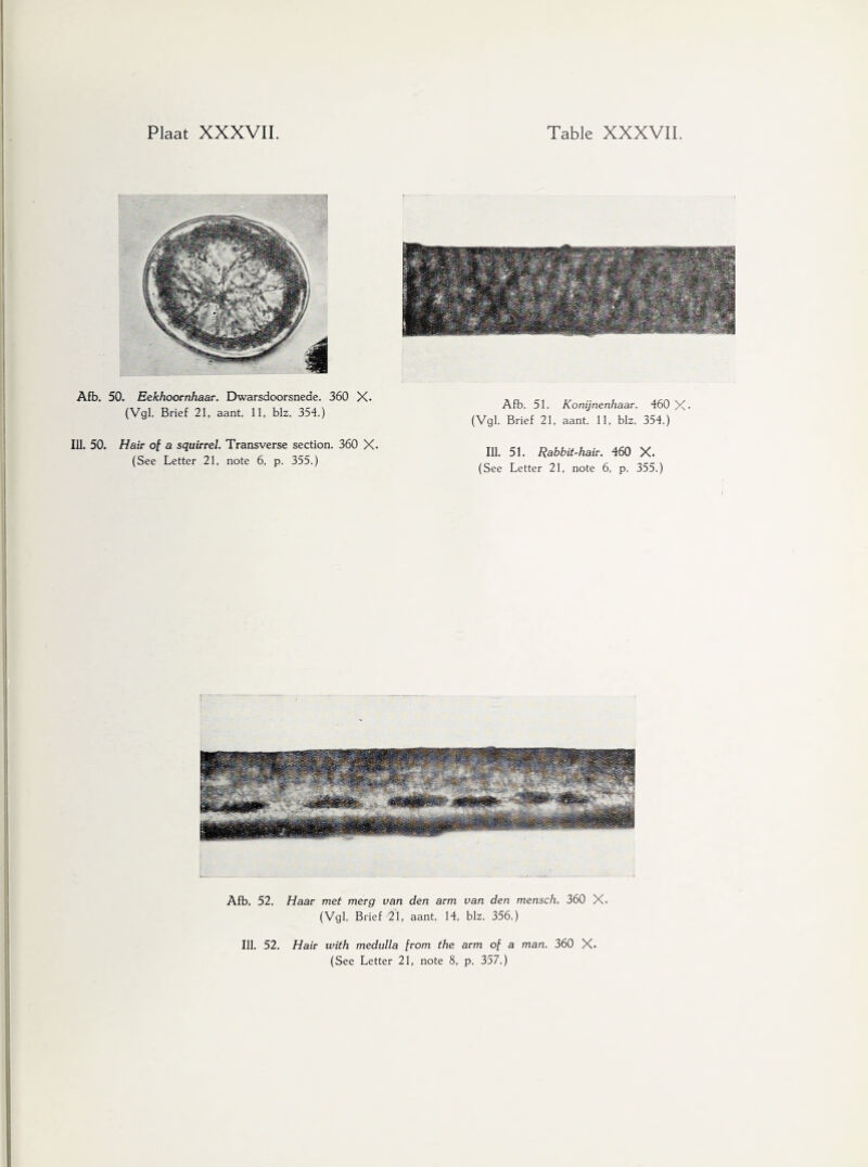 Afb. 50. Eekhoornhaar. Dwarsdoorsnede. 360 X. (Vgl. Brief 21, aant. 11, blz. 354.) Afb. 51. Konijnenhaar. 460 X* (Vgl. Brief 21, aant. 11, blz. 354.) Ill. 50. Hair of a squirrel. Transverse section. 360 X. (See Letter 21, note 6, p. 355.) Ill. 51. Rabbit-hair. 460 X. (See Letter 21, note 6, p. 355.) Afb. 52. Haar met merg van den arm van den mensch. 360 X. (Vgl. Brief 21, aant. 14, blz. 356.) Ill. 52. Hair with medulla from the arm of a man. 360 X.