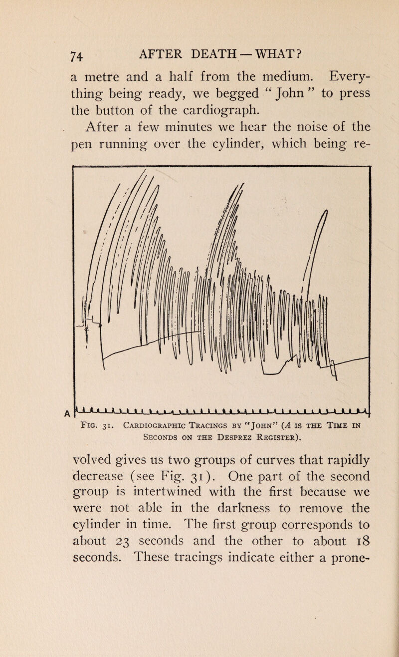 a metre and a half from the medium. Every¬ thing being ready, we begged “ John ” to press the button of the cardiograph. After a few minutes we hear the noise of the pen running over the cylinder, which being re- Fig. 31. Cardiographic Tracings by John” (A is the Time in Seconds on the Desprez Register). volved gives us two groups of curves that rapidly decrease (see Fig. 31). One part of the second group is intertwined with the first because we were not able in the darkness to remove the cylinder in time. The first group corresponds to about 23 seconds and the other to about 18 seconds. These tracings indicate either a prone-