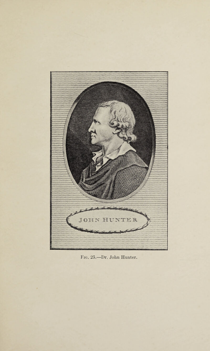 Fig. 25.—Dr. John Hunter