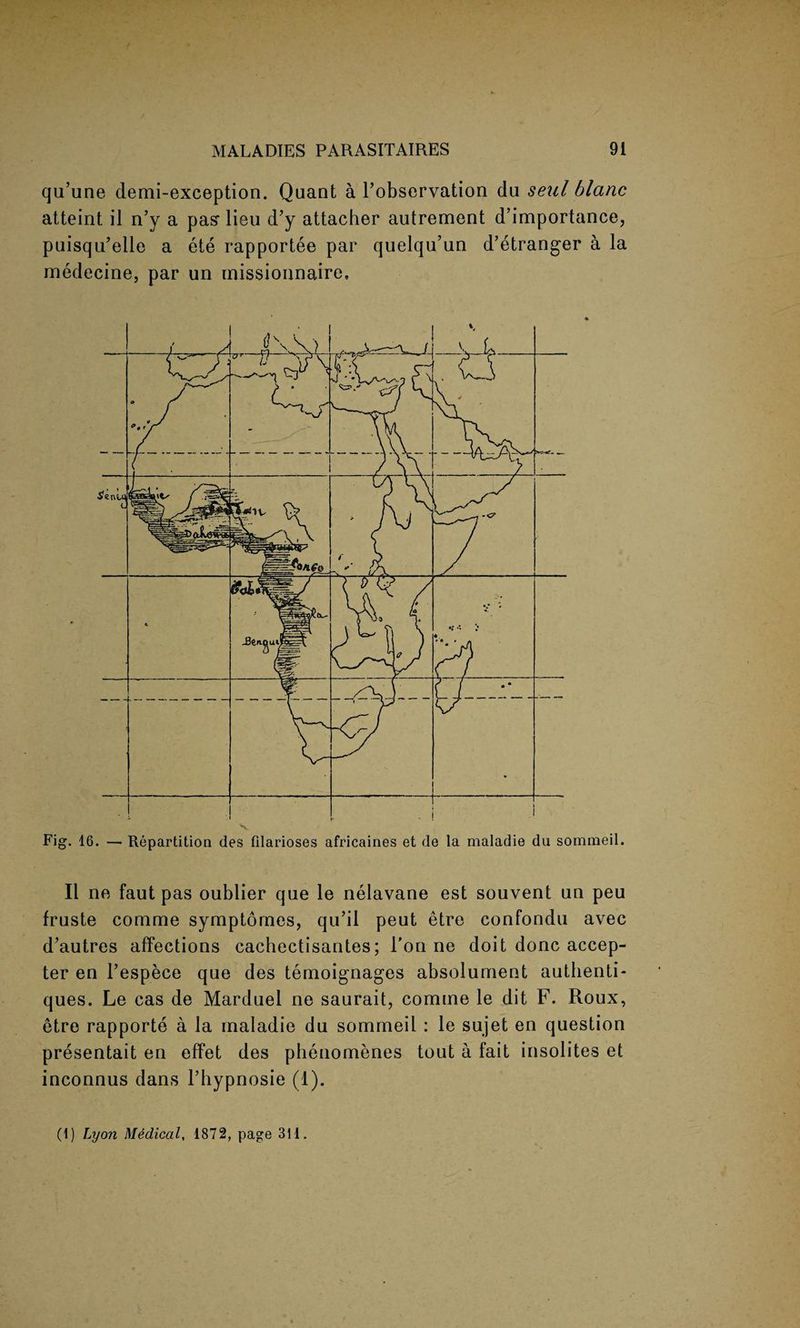 qu’une demi-exception. Quant a l’observation du seul blanc atteint il n’y a pas' lieu d’y attacher autrement d’importance, puisqu’elle a ete rapportee par quelqu’un d’etranger a la medecine, par un missioanaire. II ne faut pas oublier que le nelavane est souvent un peu fruste comme symptomes, qu’il peut etre confondu avec d’autres affections cachectisantes; l’on ne doit done accep¬ ter en l’espece que des temoignages absolunient authentic ques. Le cas de Marduel ne saurait, comine le dit F. Roux, etre rapporte a la maladie du sommeil : le sujet en question presentait en effet des phenomenes tout a fait insolites et inconnus dans Thypnosie (1). (1) Lyon Medical, 1872, page 311.