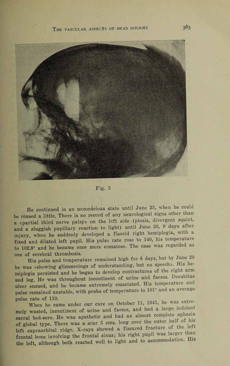 Fig. 3 Ho continued in an unconscious state until June 2-3, when he could be roused a little. There is no record of any neurological signs other than a «partial third nerve palsy» on the left side 1 (ptosis, divergent squint, and a sluggish pupillary reaction to light) until June 26, 9 days aftei injury, when he suddenly developed a flaccid right hemiplegia, with a fixed and dilated left pupil. His pulse rate rose to 140, his temperature to 102.8° and he became once more comatose. The case was regarded as one of cerebral thrombosis. His pulse and temperature remained high for 8 days, but by June he was «showing glimmerings of understanding, but no speeeh». His he¬ miplegia persisted and he began to develop contractures of the right arm and leg. He was throughout incontinent of urine and faeces. Decubitus ulcer ensued, and he became extremely emaciated. His temperature anc pulse remained unstable, with peaks of temperature to 101° and an average pulse rate of 110. When he came under our care on October 11, 1941, he was extre¬ mely wasted, incontinent of urine and faeces, and had a large m 0 en sacral bed-sore. He was apathetic and had an almost complete aphasia of global type. There was a scar 3 cms. long over the outer half of his left supraorbital ridge. X-rays showed a fissured fracture of the e frontal bone involving the frontal sinus; his right pupil was larger t the left, although both reacted well to light and to accommo a ion.