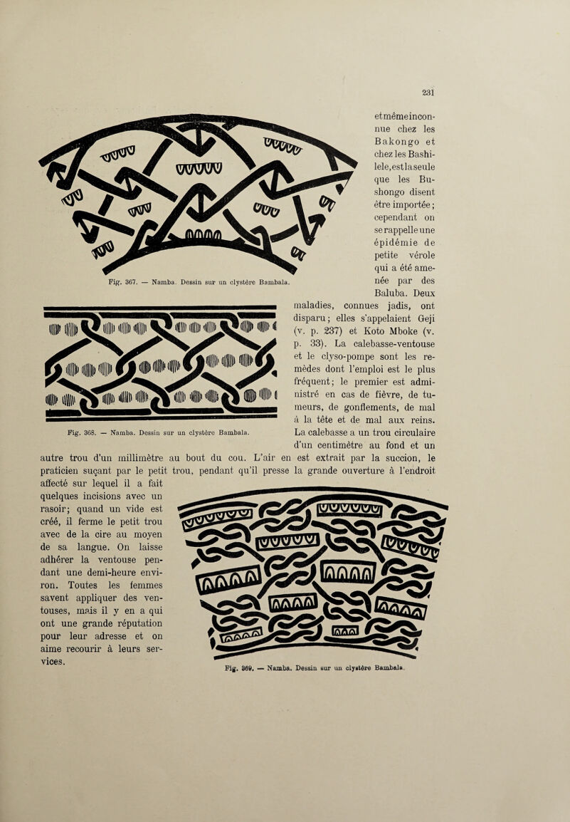 Fig. 368. — Namba. Dessin sur un clystère Bambala. autre trou d’un millimètre au bout du cou. L’air en praticien suçant par le petit trou, pendant qu’il presse affecté sur lequel il a fait quelques incisions avec un rasoir; quand un vide est créé, il ferme le petit trou avec de la cire au moyen de sa langue. On laisse adhérer la ventouse pen¬ dant une demi-heure envi¬ ron. Toutes les femmes savent appliquer des ven¬ touses, mais il y en a qui ont une grande réputation pour leur adresse et on aime recourir à leurs ser¬ vices. etmêmeincon* nue chez les Bakongo et chez les Bashi- lele, est la seule que les Bu- shongo disent être importée ; cependant on se rappelle une épidémie de petite vérole qui a été ame¬ Baluba. Deux maladies, connues jadis, ont disparu; elles s’appelaient Geji (v. p. 237) et Koto Mboke (v. p. 33). La calebasse-ventouse et le clyso-pompe sont les re¬ mèdes dont l’emploi est le plus fréquent; le premier est admi¬ nistré en cas de fièvre, de tu¬ meurs, de gonflements, de mal à la tête et de mal aux reins. La calebasse a un trou circulaire d'un centimètre au fond et un est extrait par la succion, le la grande ouverture à l’endroit s