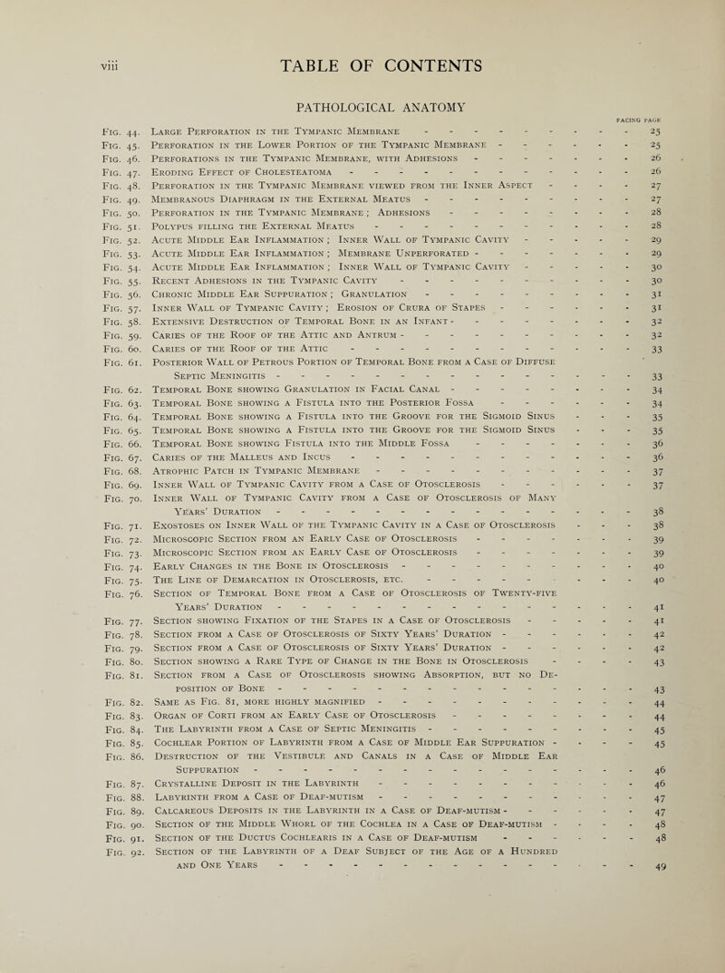PATHOLOGICAL ANATOMY FACING PAGE Fig. 44. Large Perforation in the Tympanic Membrane.- - 25 Fig. 45. Perforation in the Lower Portion of the Tympanic Membrane ----- - 25 Fig. 46. Perforations in the Tympanic Membrane, with Adhesions ------ . 26 Fig. 47. Eroding Effect of Cholesteatoma.- - - - 26 Fig. 48. Perforation in the Tympanic Membrane viewed from the Inner Aspect 27 Fig. 49. Membranous Diaphragm in the External Meatus -------- - 27 Fig. 50. Perforation in the Tympanic Membrane; Adhesions ------- . 28 Fig. 51. Polypus filling the External Meatus - -- -- -- -- --28 Fig. 52. Acute Middle Ear Inflammation ; Inner Wall of Tympanic Cavity ----- 29 Fig. 53. Acute Middle Ear Inflammation ; Membrane Unperforated ------ - 29 Fig. 54. Acute Middle Ear Inflammation ; Inner Wall of Tympanic Cavity ----- 30 Fig. 55. Recent Adhesions in the Tympanic Cavity - -- -- -- -- -30 Fig. 56. Chronic Middle Ear Suppuration; Granulation - -- -- -- - . 31 Fig. 57. Inner Wall of Tympanic Cavity; Erosion of Crura of Stapes ------ 31 Fig. 58. Extensive Destruction of Temporal Bone in an Infant -------- 32 Fig. 59. Caries of the Roof of the Attic and Antrum -------- - - 32 Fig. 60. Caries of thf: Roof of the Attic - -- -- -- -- -- . 33 Fig. 61. Posterior Wall of Petrous Portion of Temporal Bone from a Case of Diffuse Septic Meningitis - -- -- -- -- -- -- --33 Fig. 62. Temporal Bone showing Granulation in Facial Canal -------- 34 Fig. 63. Temporal Bone showing a Fistula into the Posterior Fossa.- 34 Fig. 64. Temporal Bone showing a Fistula into the Groove for the Sigmoid Sinus 35 Fig. 65. Temporal Bone showing a Fistula into the Groove for the Sigmoid Sinus 35 Fig. 66. Temporal Bone showing Fistula into the Middle Fossa ------- 36 Fig. 67. Caries of the Malleus and Incus - -- -- -- -- -- - 36 Fig. 68. Atrophic Patch in Tympanic Membrane - -- -- -- -- - . 37 Fig. 69. Inner Wall of Tympanic Cavity from a Case of Otosclerosis - - 37 Fig. 70. Inner Wall of Tympanic Cavity from a Case of Otosclerosis of Many Years’ Duration - - -.------ 38 Fig. 71. Exostoses on Inner Wall of the Tympanic Cavity in a Case of Otosclerosis 38 Fig. 72. Microscopic Section from an Early Case of Otosclerosis ------- 39 Fig. 73. Microscopic Section from an Early Case of Otosclerosis ------- 39 Fig. 74. Early Changes in the Bone in Otosclerosis ---------- 40 Fig. 75. The Line of Demarcation in Otosclerosis, etc. --------- 40 Fig. 76. Section of Temporal Bone from a Case of Otosclerosis of Twenty-five Years’ Duration - - - -.- -41 Fig. 77. Section showing Fixation of the Stapes in a Case of Otosclerosis - - - - - 41 Fig. 78. Section from a Case of Otosclerosis of Sixty Years’ Duration ------ 42 Fig. 79. Section from a Case of Otosclerosis of Sixty Years’ Duration ----- 42 Fig. 80. Section showing a Rare Type of Change in the Bone in Otosclerosis 43 Fig. 81. Section from a Case of Otosclerosis showing Absorption, but no De¬ position of Bone.------ -43 Fig. 82. Same as Fig. 81, more highly magnified ----------- 44 Fig. 83. Organ of Corti from an Early Case of Otosclerosis ------- - 44 Fig. 84. The Labyrinth from a Case of Septic Meningitis --------- 45 Fig. 85. Cochlear Portion of Labyrinth from a Case of Middle Ear Suppuration - - - - 45 Fig. 86. Destruction of the Vestibule and Canals in a Case of Middle Ear Suppuration - -- -- -- -- -- -- -- . 46 Fig. 87. Crystalline Deposit in the Labyrinth -.-46 Fig. 88. Labyrinth from a Case of Deaf-mutism - -- -- -- -..-47 Fig. 89. Calcareous Deposits in the Labyrinth in a Case of Deaf-mutism.- 47 Fig. 90. Section of the Middle Whorl of the Cochlea in a Case of Deaf-mutism 48 Fig. 91. Section of the Ductus Cochlearis in a Case of Deaf-mutism ------ 48 Fig. 92. Section of the Labyrinth of a Deaf Subject of the Age of a Hundred and One Years -------------- -49
