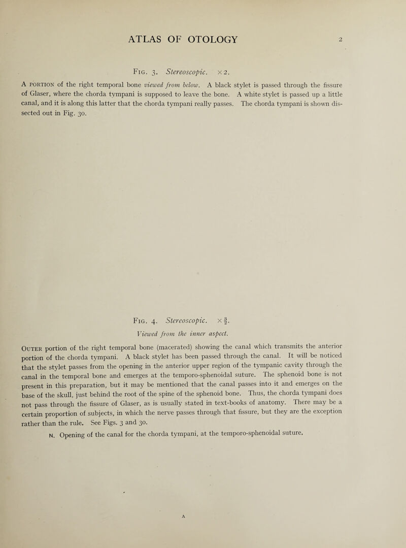 Fig. 3. Stereoscopic. X2. A portion of the right temporal bone viewed from below. A black stylet is passed through the fissure of Glaser, where the chorda tympani is supposed to leave the bone. A white stylet is passed up a little canal, and it is along this latter that the chorda tympani really passes. The chorda tympani is shown dis¬ sected out in Fig. 30. Fig. 4. Stereoscopic. xf. Viewed from the inner aspect. Outer portion of the right temporal bone (macerated) showing the canal which transmits the anterior portion of the chorda tympani. A black stylet has been passed through the canal. It will be noticed that the stylet passes from the opening in the anterior upper region of the tympanic cavity through the canal in the temporal bone and emerges at the temporo-sphenoidal suture. The sphenoid bone is not present in this preparation, but it may be mentioned that the canal passes into it and emerges on the base of the skull, just behind the root of the spine of the sphenoid bone. Thus, the chorda tympani does not pass through the fissure of Glaser, as is usually stated in text-books of anatomy. There may be a certain proportion of subjects, in which the nerve passes through that fissure, but they are the exception rather than the rule. See Figs. 3 and 30. N. Opening of the canal for the chorda tympani, at the temporo-sphenoidal suture.