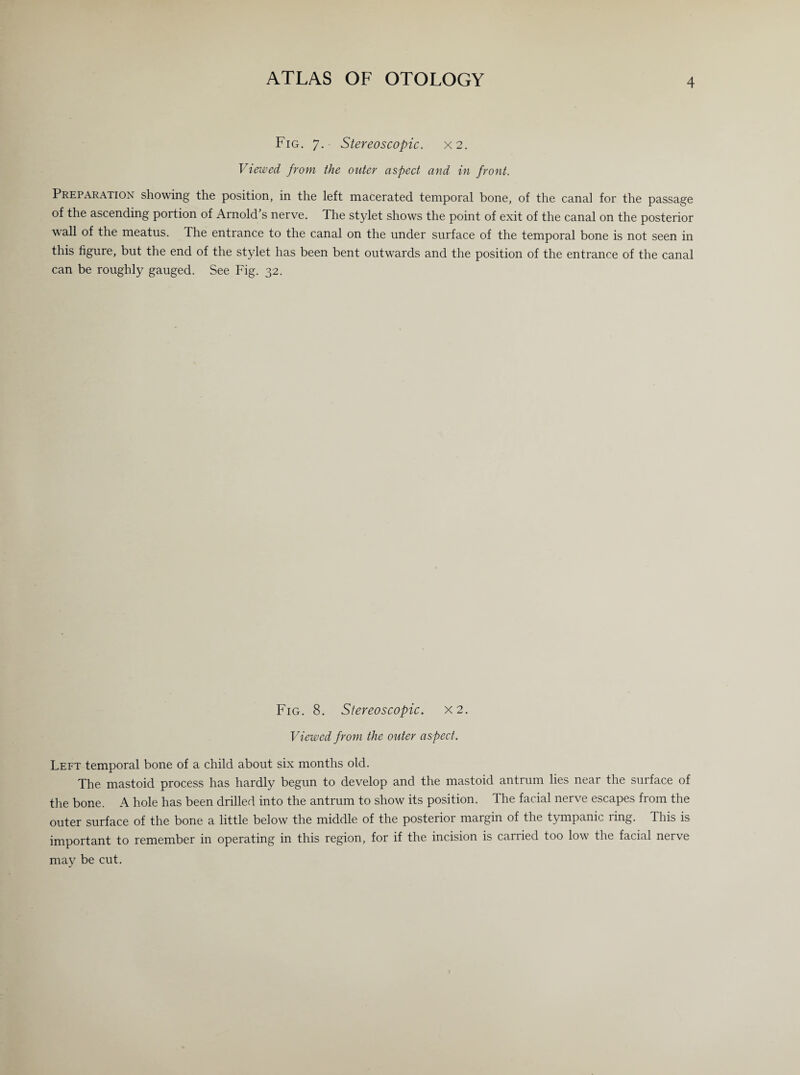Fig. 7. Stereoscopic. X2. Viewed from the outer aspect and in front. Preparation showing the position, in the left macerated temporal bone, of the canal for the passage of the ascending portion of Arnold's nerve. The stylet shows the point of exit of the canal on the posterior wall of the meatus. The entrance to the canal on the under surface of the temporal bone is not seen in this figure, but the end of the stylet has been bent outwards and the position of the entrance of the canal can be roughly gauged. See Fig. 32. Fig. 8. Stereoscopic. X2. Viewed from the outer aspect. Left temporal bone of a child about six months old. The mastoid process has hardly begun to develop and the mastoid antrum lies near the surface of the bone. A hole has been drilled into the antrum to show its position. The facial nerve escapes from the outer surface of the bone a little below the middle of the posterior margin of the tympanic ring. This is important to remember in operating in this region, for if the incision is carried too low the facial nerve may be cut.