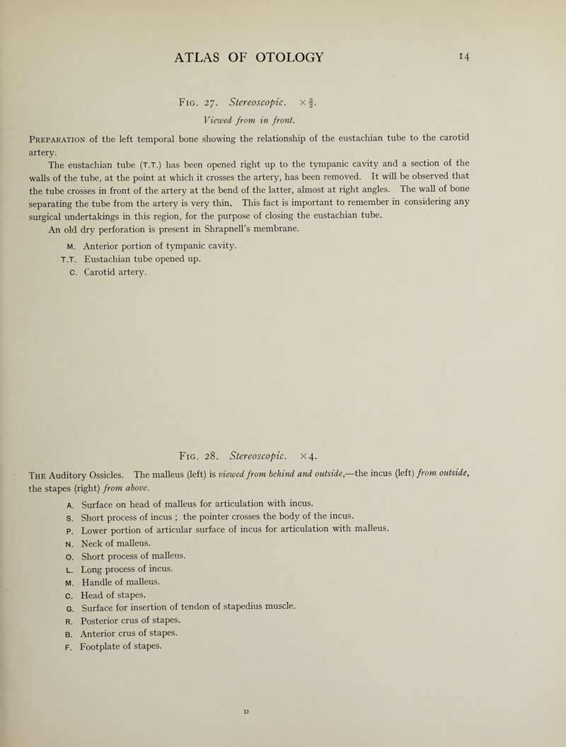 Fig. 27. Stereoscopic, xf. Viewed from in front. Preparation of the left temporal bone showing the relationship of the eustachian tube to the carotid artery. The eustachian tube (T.T.) has been opened right up to the tympanic cavity and a section of the walls of the tube, at the point at which it crosses the artery, has been removed. It will be observed that the tube crosses in front of the artery at the bend of the latter, almost at right angles. The wall of bone separating the tube from the artery is very thin. This fact is important to remember in considering any surgical undertakings in this region, for the purpose of closing the eustachian tube. An old dry perforation is present in Shrapnell’s membrane. M. Anterior portion of tympanic cavity. T.T. Eustachian tube opened up. C. Carotid artery. Fig. 28. Stereoscopic. X4. The Auditory Ossicles. The malleus (left) is viewed from behind and outside,—the incus (left) from outside, the stapes (right) from above. A. Surface on head of malleus for articulation with incus. S. Short process of incus ; the pointer crosses the body of the incus. P. Lower portion of articular surface of incus for articulation with malleus. N. Neck of malleus. O. Short process of malleus. L. Long process of incus. M. Handle of malleus. C. Head of stapes. G. Surface for insertion of tendon of stapedius muscle. R. Posterior crus of stapes. B. Anterior crus of stapes. F. Footplate of stapes. D