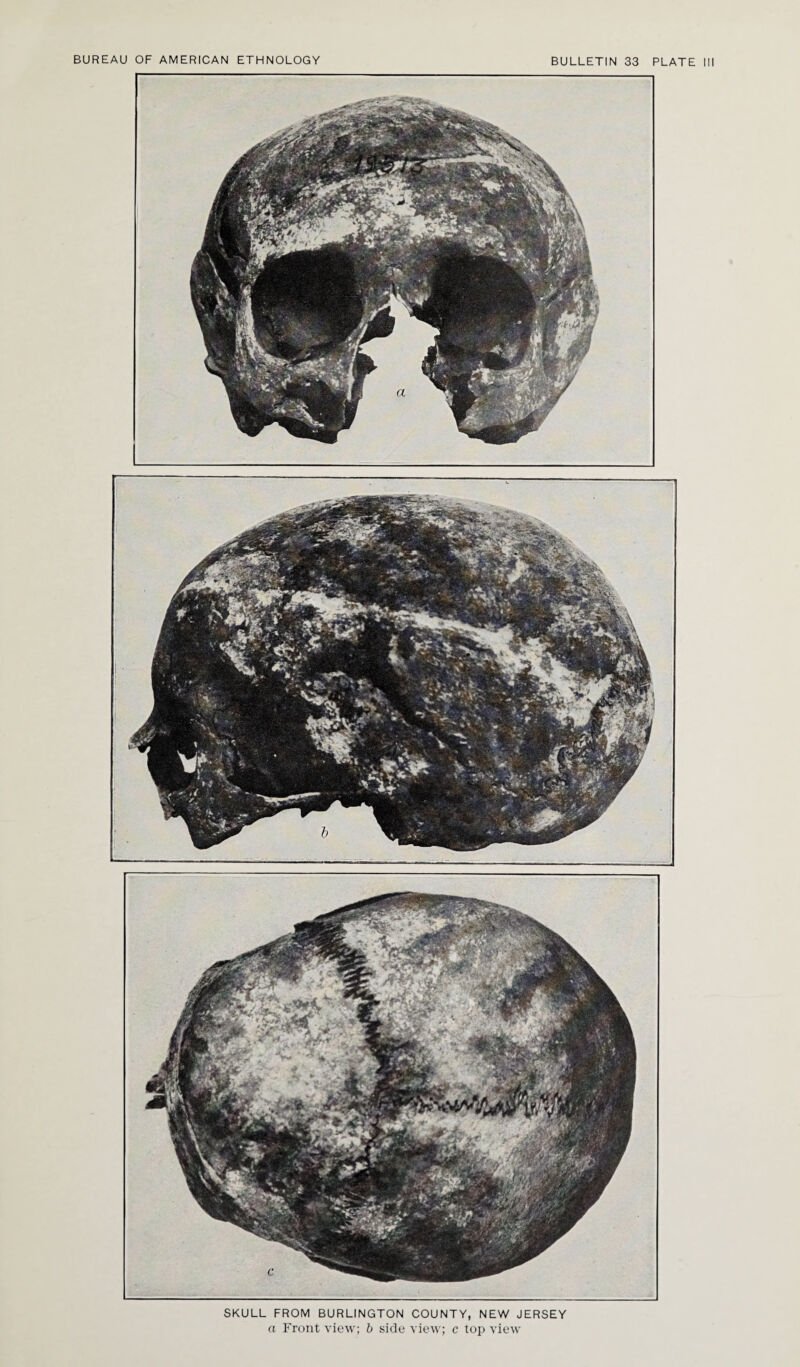 SKULL FROM BURLINGTON COUNTY, NEW JERSEY a Front view; b side view; c top view