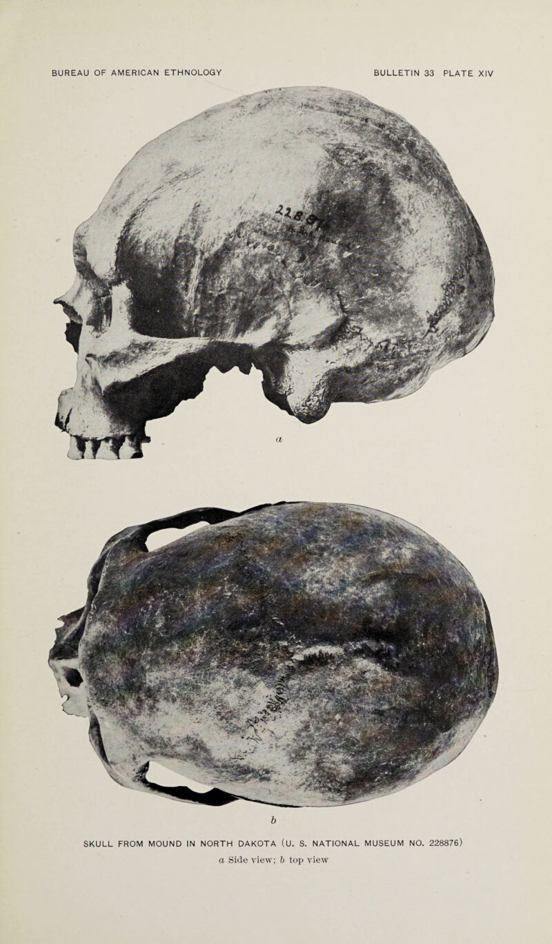 SKULL FROM MOUND IN NORTH DAKOTA (U. S. NATIONAL MUSEUM NO. 228876)