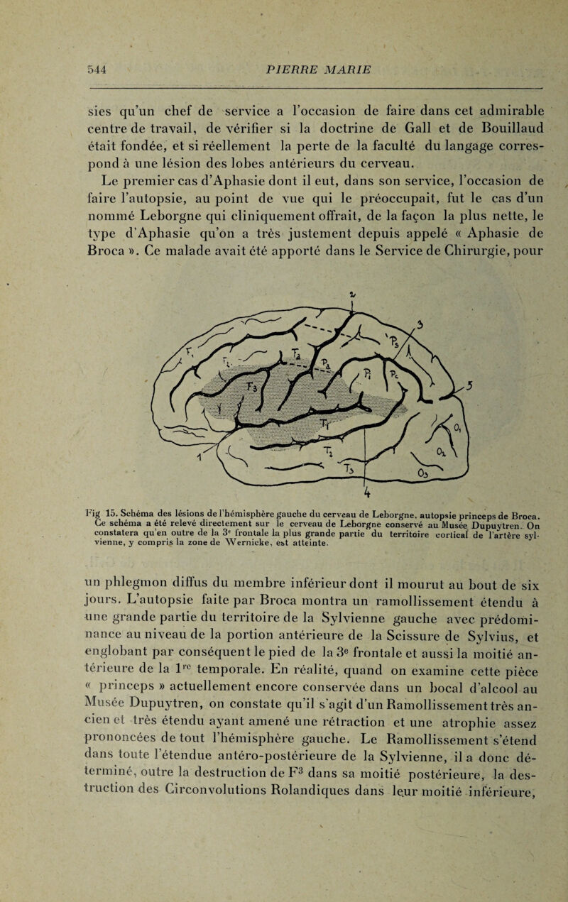 sies qu’un chef de service a l’occasion de faire dans cet admirable centre de travail, de vérifier si la doctrine de Gall et de Bouillaud était fondée, et si réellement la perte de la faculté du langage corres¬ pond à une lésion des lobes antérieurs du cerveau. Le premier cas d’Aphasie dont il eut, dans son service, l’occasion de faire l’autopsie, au point de vue qui le préoccupait, fut le cas d’un nommé Leborgne qui cliniquement offrait, de la façon la plus nette, le type d’Aphasie qu’on a très justement depuis appelé « Aphasie de Broca ». Ce malade avait été apporté dans le Service de Chirurgie, pour -i v Fig 15. Schéma des lésions de l’hémisphère gauche du cerveau de Leborgne, autopsie princeps de Broca. Ce schéma a été relevé directement sur le cerveau de Leborgne conservé au Musée Dupuytren. On constatera qu’en outre de la 3e frontale la plus grande partie du territoire cortical de l’artère syl- vienne, y compris la zone de Wernicke, est atteinte. un phlegmon diffus du membre inférieur dont il mourut au bout de six jours. L’autopsie faite par Broca montra un ramollissement étendu à une grande partie du territoire de la Sylvienne gauche avec prédomi¬ nance au niveau de la portion antérieure de la Scissure de Sylvius, et englobant par conséquent le pied de la 3e frontale et aussi la moitié an¬ térieure de la lro temporale. En réalité, quand on examine cette pièce « princeps » actuellement encore conservée dans un bocal d’alcool au Musée Dupuytren, on constate qu’il s'agit d’un Ramollissement très an¬ cien et très étendu ayant amené une rétraction et une atrophie assez prononcées de tout l’hémisphère gauche. Le Ramollissement s’étend dans toute l’étendue antéro-postérieure de la Sylvienne, il a donc dé¬ terminé, outre la destruction de F3 dans sa moitié postérieure, la des- tiuction des Circonvolutions Rolandiques dans le.ur moitié inférieure,