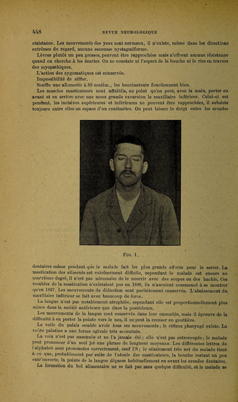 résistance. Les mouvements des yeux sont normaux, il n’existe, même dans les directions extrêmes du regard, aucune secousse nystagmiforme. Lèvres plutôt un peu grosses, peuvent être rapprochées mais n’offrent aucune résistance quand on cherche à les écarter. On ne constate ni l’aspect de la bouche ni le rire en travers des myopathiques. L’action des zygomatiques est conservée. Impossibilité de siffler. Souffle une allumette à 80 centim., les buccinateurs fonctionnent bien. Les muscles masticateurs sont affaiblis, au point qu’on peut, avec la main, porter en avant et en arrière avec une assez grande excursion le maxillaire inférieur. Celui-ci est pendant, les incisives supérieures et inférieures ne peuvent être rapprochées, il subsiste toujours entre elles un espace d’un centimètre. On peut laisser le doigt entre les arcades Fig. 1. dentaires même pendant qiie le malade fait les plus grands efforts pour le serrer. La mastication des aliments est extrêmement difficile, cependant le malade est encore au quatrième degré, il n’est pas nécessaire de le nourrir avec des soupes ou des hachis. Ces troubles de la mastication n’existaient pas en 1896, ils n’auraient commencé à se montrer qu’en 1897. Les mouvements de diduction sont parfaitement conservés. L’abaissement du maxillaire inférieur se fait avec beaucoup de force. La langue n’est pas notablement atrophiée, cependant elle est proportionnellement plus mince dans la moitié antérieure que dans la postérieure. Les mouvements de la langue sont conservés dans leur ensemble, mais il éprouve de la difficulté à en porter la pointe vers le nez, il ne peut la creuser en gouttière. Le voile du palais semble avoir tous ses mouvements ; le réflexe pharyngé existe. La voûte palatine a une forme ogivale très accentuée. La voix n est pas nasonnée et ne l’a jamais été ; elle n’est pas entrecoupée ; le malade peut prononcer d’un seul jet une phrase de longueur moyenne. Les différentes lettres de 1 alphabet sont prononcées correctement, sauf l’S ; le zézaiement très net du malade tient à ce que, probablement par suite de l'atonie des masticateurs, la bouche restant un peu entr’ouverte, la pointe de la langue dépasse habituellement en avant les arcades dentaires. La formation du bol alimentaire ne se fait pas sans quelque difficulté, et le malade se