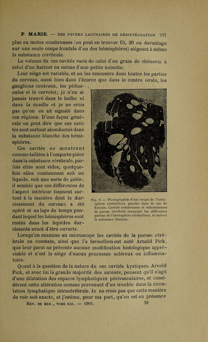 plus ou moins nombreuses (on peut en trouver 15, 20 ou davantage sur une seule coupe frontale d’un des hémisphères) siégeant à même la substance cérébrale. Le volume de ces cavités varie de celui d’un grain de chènevis à celui d’un haricot ou même d’une petite noisette. Leur siège est variable, et on les rencontre dans toutes les parties du cerveau, aussi bien dans l’écorce que dans le centre ovale, les Fig. 9. — Photographie d'une coupe de l’hémi¬ sphère cérébelleux gauche dans le cas de Touche. Cavités nombreuses et volumineuses de porose cérébrale occupant les différentes parties de l’hémisphère cérébelleux, et surtout la substance blanche. Lorsqu’on examine au microscope les cavités de la porose céré¬ brale on constate, ainsi que l’a formellement noté Arnold Pick, que leur paroi ne présente aucune modification histologique appré¬ ciable et n’est le siège d’aucun processus scléreux ou inflamma¬ toire. Quant à la question de la nature de ces cavités kystiques, Arnold Pick, et avec lui la grande majorité des auteurs, pensent qu’il s’agit d’une dilatation des espaces lymphatiques périvasculaires, et consi¬ dèrent cette altération comme provenant d’un trouble dans la circu¬ lation lymphatique intracérébrale. Je ne crois pas que cette manière de voir soit exacte, et j’estime, pour ma part, qu’on est en présence Rev. de méd., tome xxi. — 1901. -0 ganglions centraux, les pédon¬ cules et le cervelet; je n’en ai jamais trouvé dans le bulbe ni dans la moelle et je ne crois pas qu’on en ait signalé dans ces régions. D’une façon géné¬ rale on peut dire que ces cavi¬ tés sont surtout abondantes dans la substance blanche des hémi¬ sphères. Ces cavités se montrent comme taillées à Pemporte-pièce dans la substance cérébrale, par¬ fois elles sont vides, quelque¬ fois elles contiennent soit un liquide, soit une sorte de gelée; il semble que ces différences de l’aspect intérieur tiennent sur¬ tout à la manière dont le dur¬ cissement du cerveau a été opéré et au laps de temps pen¬ dant lequel les hémisphères sont restés dans les liquides dur¬ cissants avant d’être ouverts.