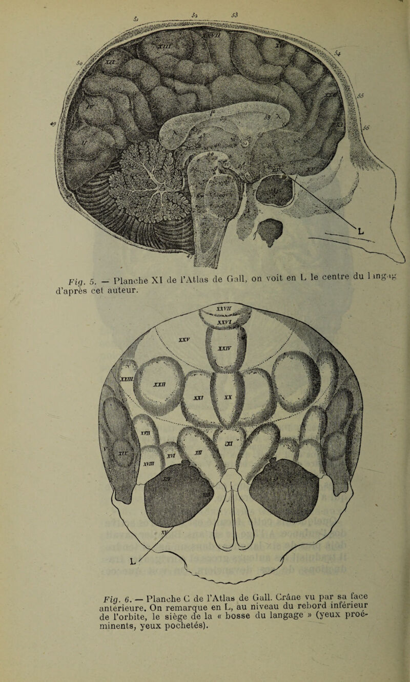 Pig, 5. _ Planche XI de l’Atlas de Gall, on voit en L le centre du 1 ingag d'après cet auteur. Fig. 6. — Planche G de l'Atlas de Gall. Crâne vu par sa face anterieure. On remarque en L, au niveau du rebord intérieur de l’orbite, le siège de la « bosse du langage » (yeux proé¬ minents, yeux pochetés).