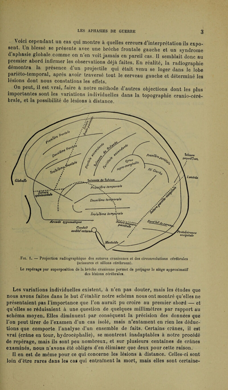 Voici cependant un cas qui montre à quelles erreurs d’interprétation ils expo¬ sent. Un blessé se présente avec une brèche frontale gauche et un syndrome d’aphasie globale comme on n’en voit jamais en pareil cas. Il semblait donc au premier abord infirmer les observations déjà faites. En réalité, la radiographie démontra la présence d un projectile qui était venu se loger dans le lobe paiiéto-temporal, après avoir traversé tout le cerveau gauche et déterminé les lésions dont nous constations les effets. On peut, il est vrai, faire à notre méthode d’autres objections dont les plus impoi tantes sont les variations individuelles dans la topographie cranio-céré- brale, et la possibilité de lésions à distance. Fig. 1. — Projection radiographique des sutures crâniennes et des circonvolutions cérébrales (scissures et sillons cérébraux). Le repérage par superposition de la brèche crânienne permet de préjuger le siège approximatif des lésions cérébrales. Les variations individuelles existent, à n’en pas douter, mais les études que nous avons faites dans le but d’établir notre schéma nous ont montré qu’elles ne présentaient pas l’importance que l’on aurait pu croire au premier abord — et qu’elles se réduisaient à une question de quelques millimètres par rapport au schéma moyen. Elles diminuent par conséquent la précision des données que l’on peut tirer de l’examen d’un cas isolé, mais n’entament en rien les déduc¬ tions que comporte l’analyse d’un ensemble de faits. Certains crânes, il est vrai (crâne en tour, hydrocéphalie), se montrent inadaptables à notre procédé de repérage, mais ils sont peu nombreux, et sur plusieurs centaines de crânes examinés, nous n’avons été obligés d’en éliminer que deux pour cette raison. Il en est de même pour ce qui concerne les lésions à distance. Celles-ci sont loin d’être rares dans les cas qui entraînent la mort, mais elles sont certaine-