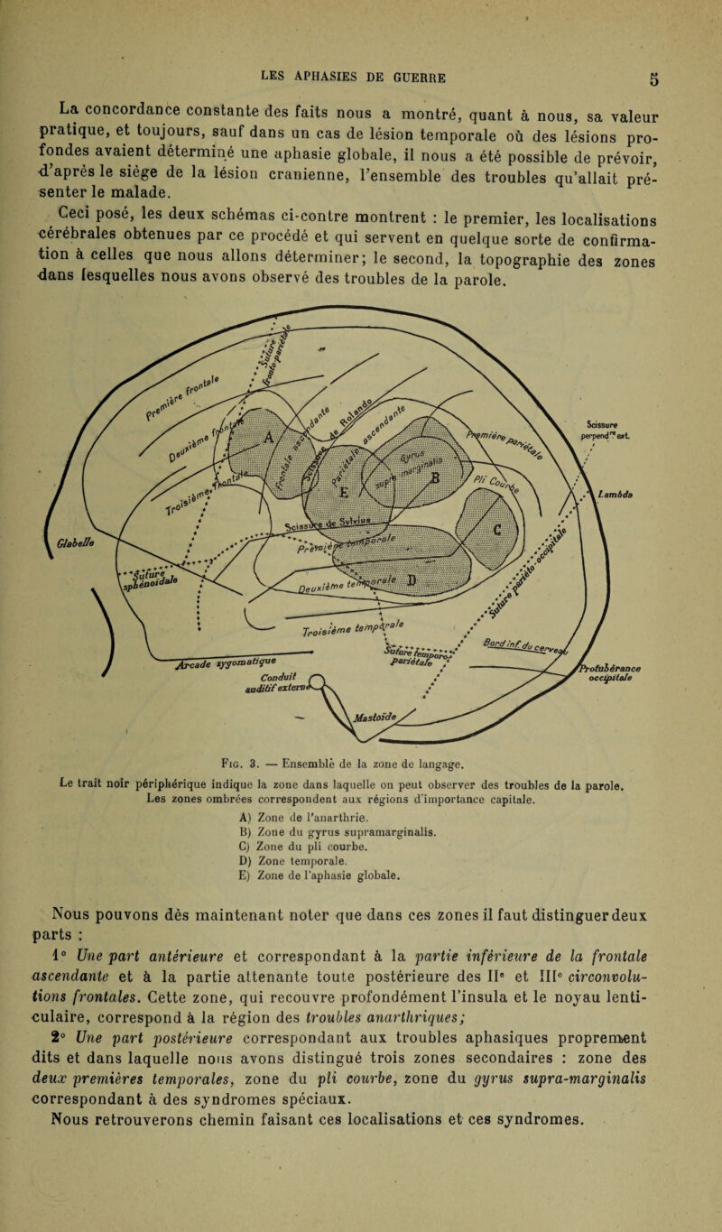 La concordance constante des faits nous a montré, quant à nous, sa valeur pratique, et toujours, sauf dans un cas de lésion temporale où des lésions pro¬ fondes avaient déterminé une aphasie globale, il nous a été possible de prévoir, d’après le siège de la lésion crânienne, l’ensemble des troubles qu’allait pré¬ senter le malade. Ceci posé, les deux schémas ci-contre montrent : le premier, les localisations cérébrales obtenues par ce procédé et qui servent en quelque sorte de confirma¬ tion à celles que nous allons déterminer; le second, la topographie des zones dans lesquelles nous avons observé des troubles de la parole. Fig. 3. — Ensemble de la zone de langage. Le trait noir périphérique indique la zone dans laquelle on peut observer des troubles de la parole. Les zones ombrées correspondent aux régions d’importance capitale. A) Zone de l’anarthrie. B) Zone du gyrus supramarginalis. G) Zone du pli courbe. D) Zone temporale. E) Zone de l’aphasie globale. Scissure perpend^exL >mièr>e Lambda Glabelle Pren>te, Iauxièbee ternpà\ra‘ Arcade zygomatique 'ofobérance occipitale Conduit auditif extern > Mastoïde Nous pouvons dès maintenant noter que dans ces zones il faut distinguer deux parts : 1° Une part antérieure et correspondant à la partie inférieure de la frontale ascendante et à la partie attenante toute postérieure des IIe et IIIe circonvolu¬ tions frontales. Cette zone, qui recouvre profondément l’insula et le noyau lenti¬ culaire, correspond à la région des troubles anarthriques; 2° Une part postérieure correspondant aux troubles aphasiques proprement dits et dans laquelle nous avons distingué trois zones secondaires : zone des deux premières temporales, zone du pli courbe, zone du gyrus supra-marginalis correspondant à des syndromes spéciaux. Nous retrouverons chemin faisant ces localisations et ces syndromes.