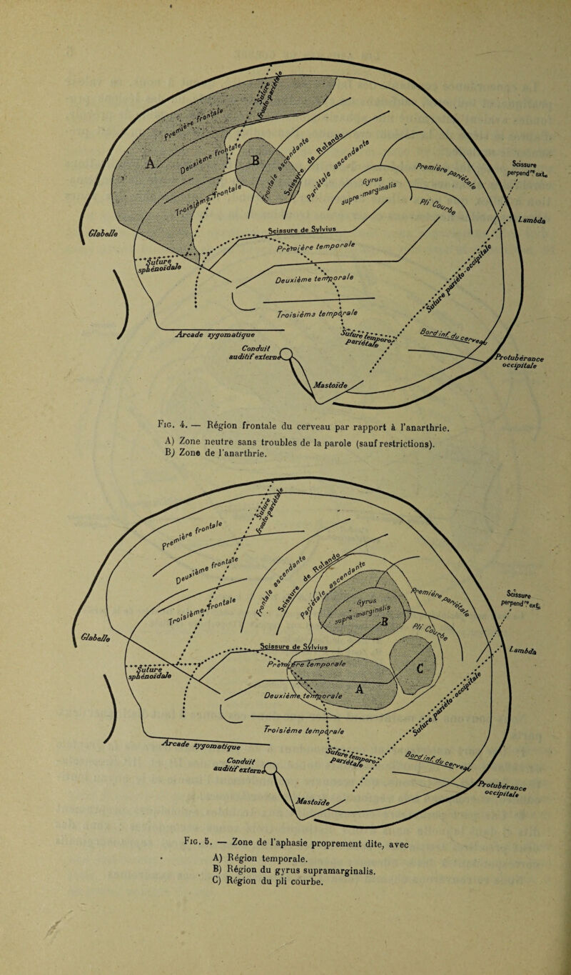GJobefle Scissure de Sfrlvius future * •énoidaJe Deuxièrrïe.te 'roisième temporale zygoiaatiçue Conduit auditif extez vcuoerance occiput Mastoide Scissure perpen d^e Scissure de Sylvius. GlabeJIe Première tempor, future ènoidaie Deuxième tertp.orale Troisième te mpàpate sufu^fe Conduit auditif extern. ''otubêrance occipitaie Mastoïde Fig. 5. — Zone de l'aphasie proprement dite, avec A) Région temporale. B) Région du gyrus supramarginalis. C) Région du pli courbe. hig. 4. — Région frontale du cerveau par rapport à l’anarthrie. A) Zone neutre sans troubles de la parole (sauf restrictions). B) Zone de l'anarthrie. Scissure PerPend y exQ Lambda