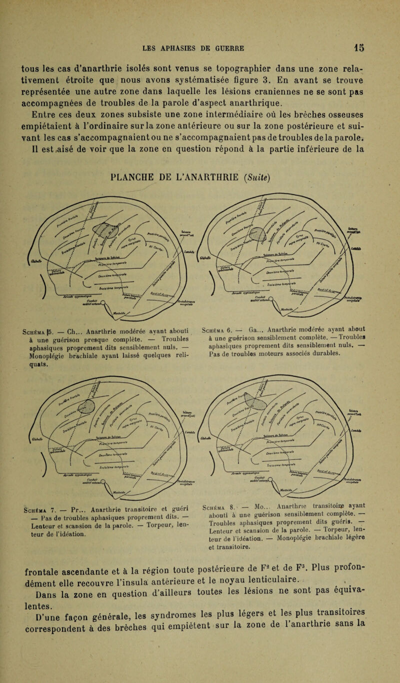 tous les cas d’anarthrie isolés sont venus se topographier dans une zone rela¬ tivement étroite que nous avons systématisée figure 3. En avant se trouve représentée une autre zone dans laquelle les lésions crâniennes ne se sont pas accompagnées de troubles de la parole d’aspect anarthrique. Entre ces deux zones subsiste une zone intermédiaire où les brèches osseuses empiétaient à l’ordinaire sur la zone antérieure ou sur la zone postérieure et sui¬ vant les cas s’accompagnaient ou ne s’accompagnaient pas de troubles de la parole. Il est,aisé de voir que la zone en question répond à la partie inférieure de la PLANCHE DE L’ANARTHRIE (Suite) Schéma |5. — Ch... Anarthrie modérée ayant abouti à une guérison presque complète. — Troubles aphasiques proprement dits sensiblement nuis. — Monoplégie brachiale ayant laissé quelques reli¬ quats. Schéma 7. — Pr... Anarthrie transitoire et guéri — Pas de troubles aphasiques proprement dits. Lenteur et scansion de la parole. — Torpeur, len¬ teur de l’idéation. Schéma 6. — Ga... Anarthrie modérée ayant about à une guérison sensiblement complète. —Troubles aphasiques proprement dits sensiblement nuis. — Pas de troubles moteurs associés durables. Schéma 8. — Mo.. Anarthrie transitoire ayant abouti à une guérison sensiblement complète. — Troubles aphasiques proprement dits guéris. — Lenteur et scansion de la parole. — Torpeur, len¬ teur de l'idéation. — Monoplégie brachiale légère et transitoire. frontale ascendante et à la région toute postérieure de F* et de F*. Plus profon¬ dément elle recouvre l’insula antérieure et le noyau lenticulaire. Dans la zone en question d'ailleurs toutes les lésions ne sont pas équiva- lentes * D’une façon générale, les syndromes les plus légers et les plus transitoires correspondent à des brèches qui empiètent sur la zone de l’anarthne sans la