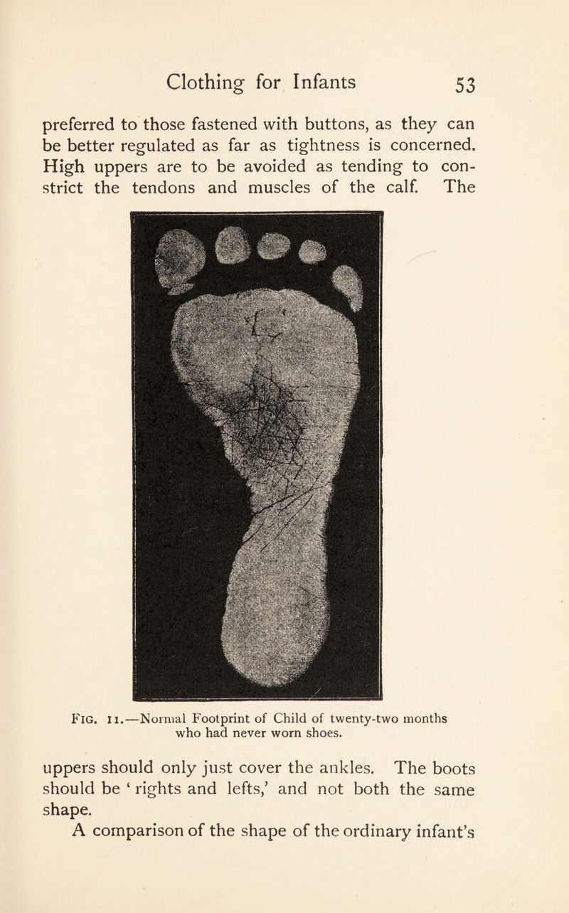 preferred to those fastened with buttons, as they can be better regulated as far as tightness is concerned. High uppers are to be avoided as tending to con¬ strict the tendons and muscles of the calf. The Fig. II.—Normal Footprint of Child of twenty-two months who had never worn shoes. uppers should only just cover the ankles. The boots should be ‘ rights and lefts/ and not both the same shape. A comparison of the shape of the ordinary infant’s