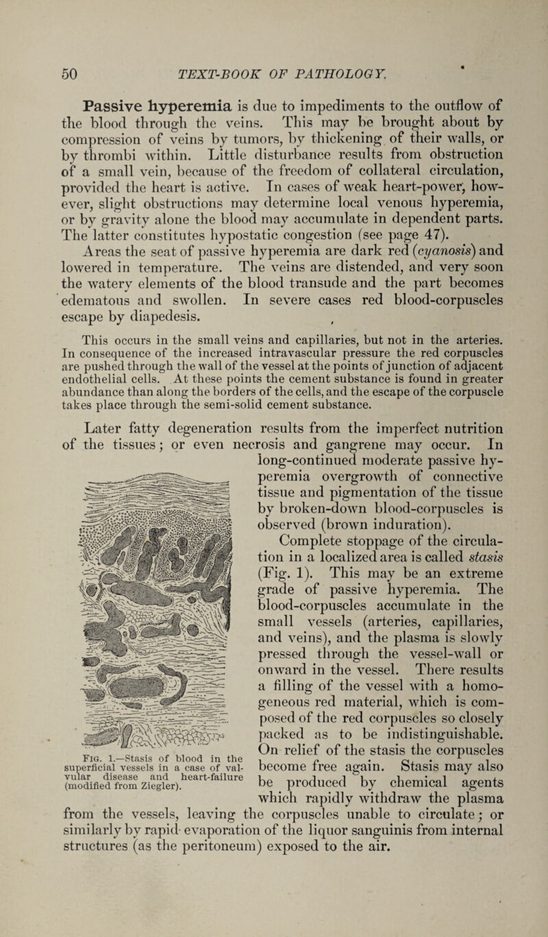 Passive hyperemia is due to impediments to the outflow of the blood through the veins. This may be brought about by compression of veins by tumors, by thickening of their walls, or by thrombi within. Little disturbance results from obstruction of a small vein, because of the freedom of collateral circulation, provided the heart is active. In cases of weak heart-power, how¬ ever, slight obstructions may determine local venous hyperemia, or by gravity alone the blood may accumulate in dependent parts. The latter constitutes hypostatic congestion (see page 47). Areas the seat of passive hyperemia are dark red (cyanosis) and lowered in temperature. The veins are distended, and very soon the watery elements of the blood transude and the part becomes edematous and swollen. In severe cases red blood-corpuscles escape by diapedesis. This occurs in the small veins and capillaries, but not in the arteries. In consequence of the increased intravascular pressure the red corpuscles are pushed through the wall of the vessel at the points of junction of adjacent endothelial cells. At these points the cement substance is found in greater abundance than along the borders of the cells, and the escape of the corpuscle takes place through the semi-solid cement substance. Later fatty degeneration results from the imperfect nutrition of the tissues; or even necrosis and gangrene may occur. In long-continued moderate passive hy¬ peremia overgrowth of connective tissue and pigmentation of the tissue by broken-down blood-corpuscles is observed (brown induration). Complete stoppage of the circula¬ tion in a localized area is called stasis (Fig. 1). This may be an extreme grade of passive hyperemia. The blood-corpuscles accumulate in the small vessels (arteries, capillaries, and veins), and the plasma is slowly pressed through the vessel-wall or onward in the vessel. There results a filling of the vessel with a homo¬ geneous red material, which is com¬ posed of the red corpuscles so closely packed as to be indistinguishable. On relief of the stasis the corpuscles become free again. Stasis may also be produced by chemical agents which rapidly withdraw the plasma from the vessels, leaving the corpuscles unable to circulate; or similarly by rapid- evaporation of the liquor sanguinis from internal structures (as the peritoneum) exposed to the air. Fig. 1.—Stasis of blood in the superficial vessels in a case of val¬ vular disease and heart-failure (modified from Ziegler).