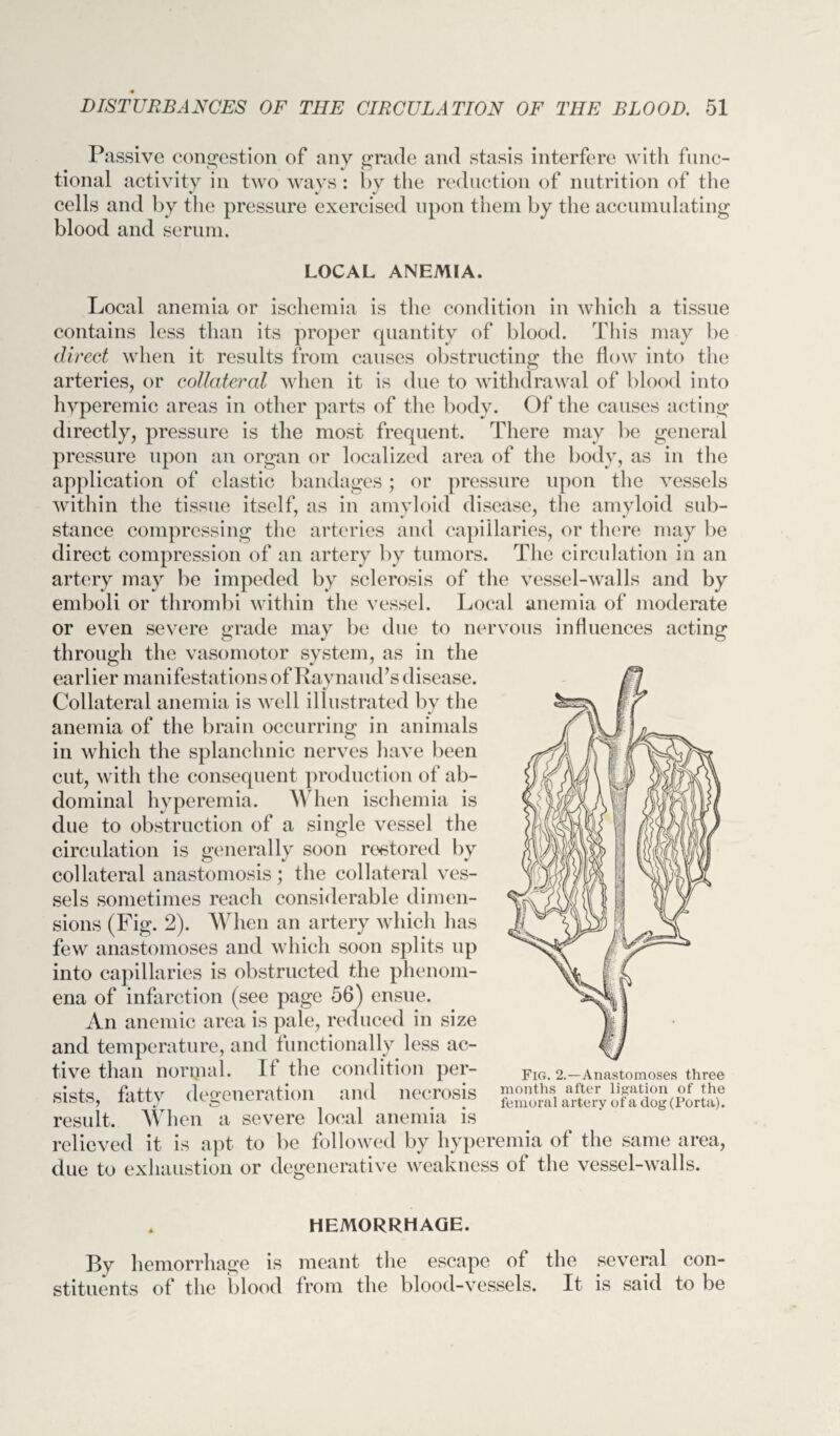 Passive congestion of any grade and stasis interfere with func¬ tional activity in two ways: by the reduction of nutrition of the cells and by the pressure exercised upon them by the accumulating blood and serum. LOCAL ANEMIA. Local anemia or ischemia is the condition in which a tissue contains less than its proper quantity of blood. This may be direct when it results from causes obstructing the flow into the arteries, or collateral when it is due to withdrawal of blood into hyperemic areas in other parts of the body. Of the causes acting directly, pressure is the most frequent. There may be general pressure upon an organ or localized area of the body, as in the application of clastic bandages; or pressure upon the vessels within the tissue itself, as in amyloid disease, the amyloid sub¬ stance compressing the arteries and capillaries, or there may be direct compression of an artery by tumors. The circulation in an artery may be impeded by sclerosis of the vessel-walls and by emboli or thrombi within the vessel. Local anemia of moderate or even severe grade may be due to nervous influences acting through the vasomotor system, as in the earlier manifestations of Raynaud’s disease. Collateral anemia is well illustrated by the anemia of the brain occurring in animals in which the splanchnic nerves have been cut, with the consequent production of ab¬ dominal hyperemia. When ischemia is due to obstruction of a single vessel the circulation is generally soon restored by collateral anastomosis; the collateral ves¬ sels sometimes reach considerable dimen¬ sions (Fig. 2). When an artery which lias few anastomoses and which soon splits up into capillaries is obstructed the phenom¬ ena of infarction (see page 56) ensue. An anemic area is pale, reduced in size and temperature, and functionally less ac¬ tive than normal. If the condition per¬ sists, fatty degeneration and necrosis result. When a severe local anemia is relieved it is apt to be followed by hyperemia of the same area, due to exhaustion or degenerative weakness of the vessel-walls. Fig. 2.—Anastomoses three months after ligation of the femoral artery of a dog (Porta). HEMORRHAGE. Ry hemorrhage is meant the escape of the several con¬ stituents of the blood from the blood-vessels. It is said to be