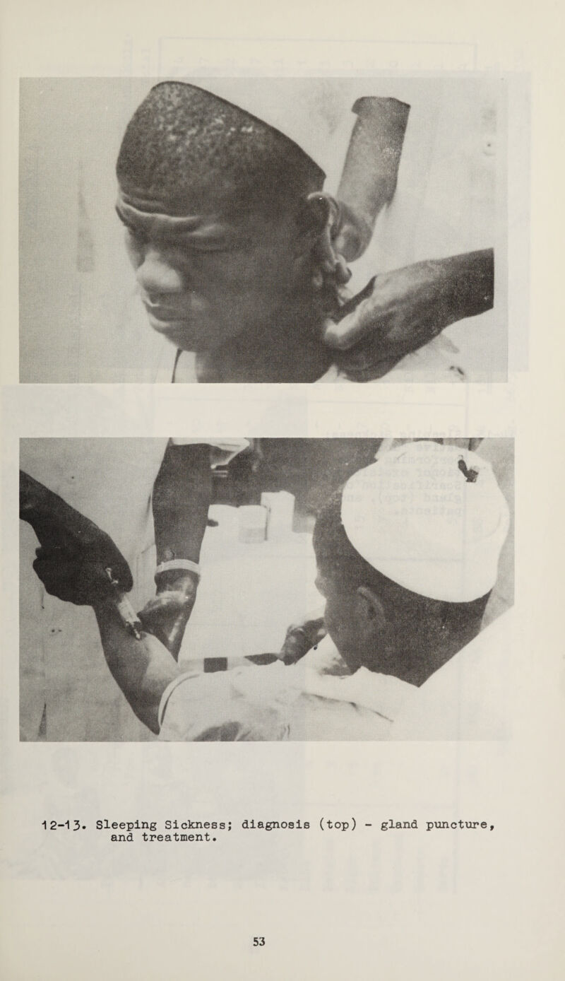 12-13* Sleeping Sickness; diagnosis (top) and treatment* gland puncture.