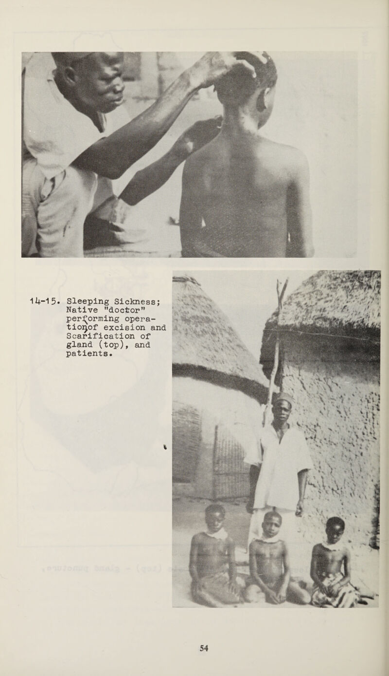 14-15. Sleeping Sickness; Native doctor” performing opera- tioi^of excision and Scarification of gland (top), and patients. i