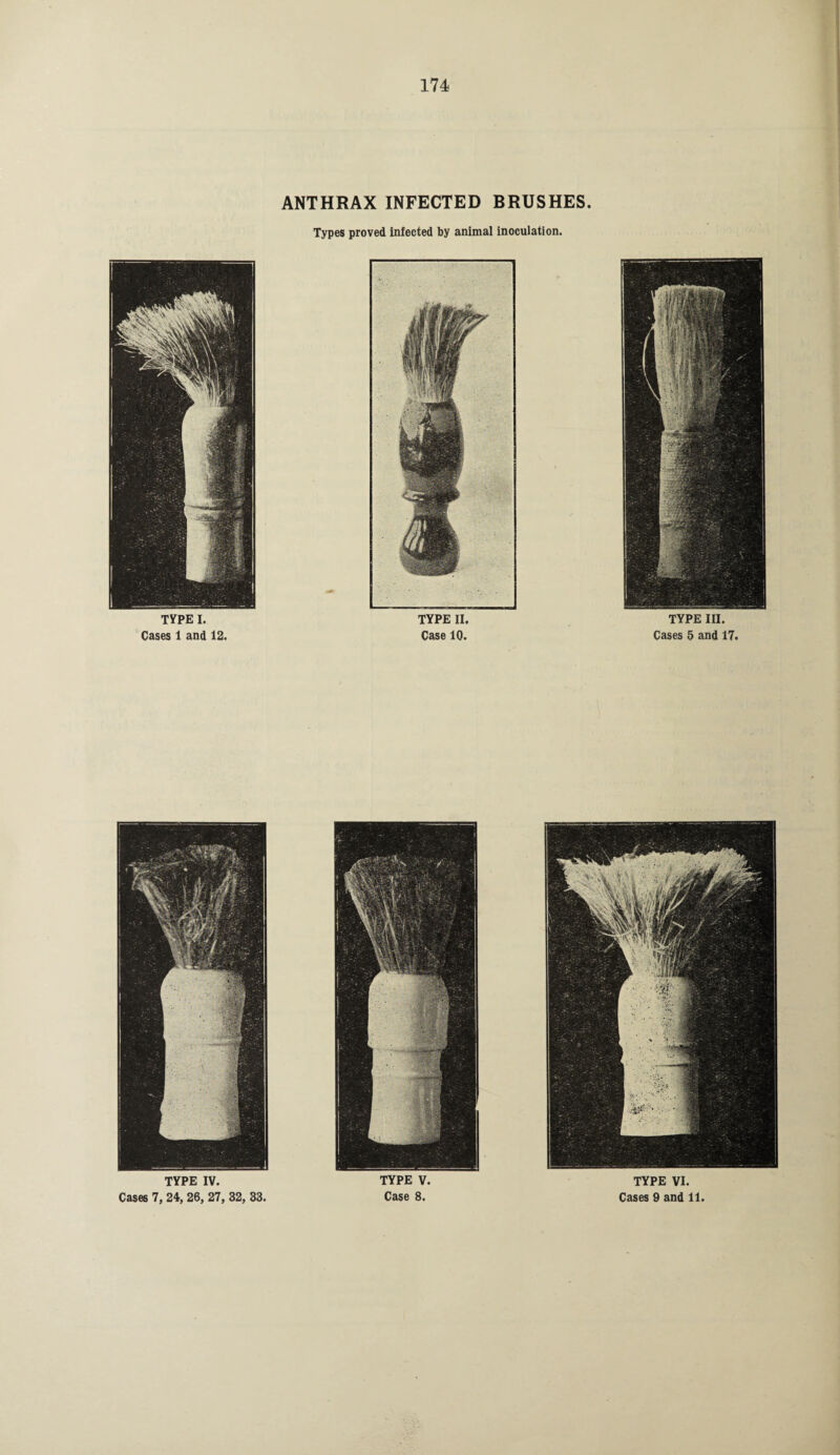 ANTHRAX INFECTED BRUSHES. Types proved infected by animal inoculation. TYPE I. Cases 1 and 12. TYPE II. Case 10. TYPE III. Cases 5 and 17. TYPE IV. Cases 7, 24, 26, 27, 32, 33. TYPE VI. Cases 9 and 11. TYPE V. Case 8.