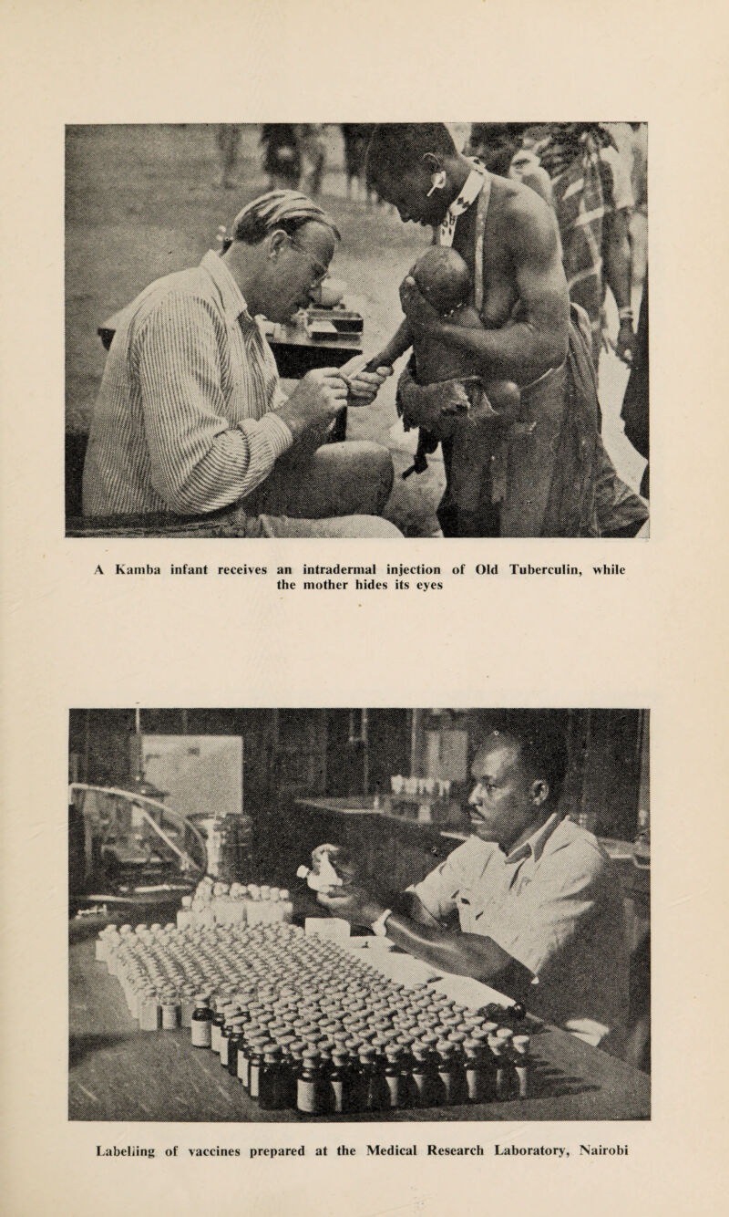A Kamba infant receives an intradernial injection of Old Tuberculin, the mother hides its eyes while Labelling of vaccines prepared at the Medical Research Laboratory, Nairobi
