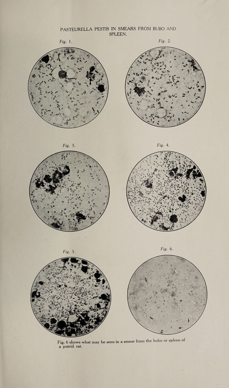 PASTEURELLA PESTIS IN SMEARS FROM BUBO AND SPLEEN. Fig. 2. Fig. 5. Fig. 6. Fig. 6 shows what may be seen in a smear from the bubo or spleen of a putrid rat.