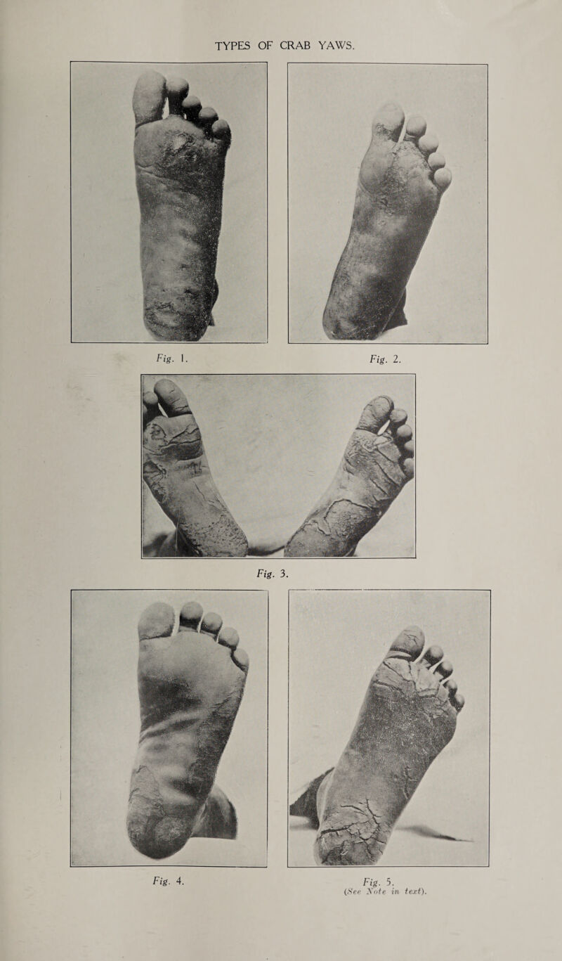 Fig. 3. Fig- 4. Fig. 3. (See Note in text).
