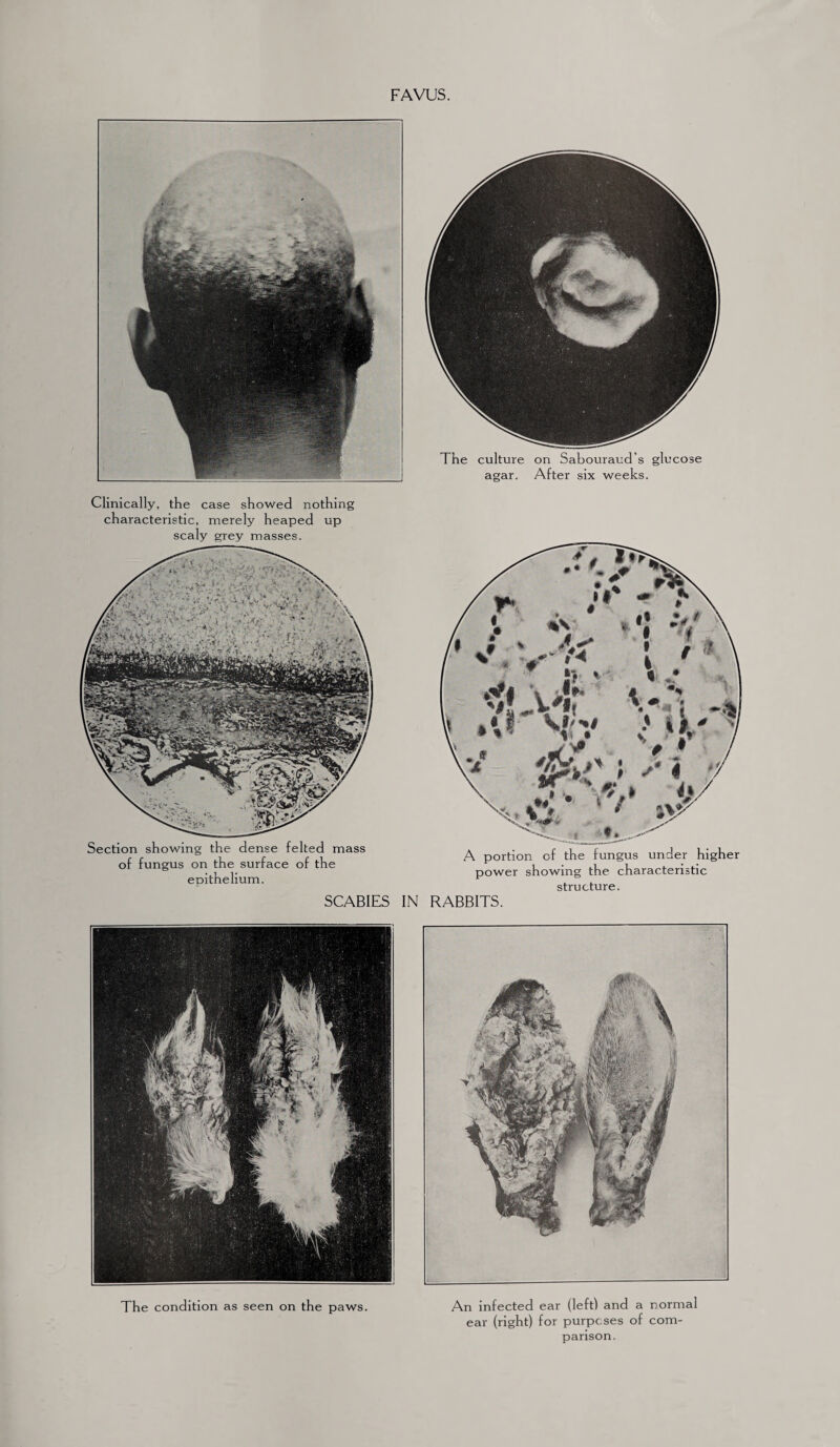 FAVUS. Clinically, the case showed nothing characteristic, merely heaped up scaly grey masses. Section showing the dense felted mass of fungus on the surface of the epithelium. A portion of the fungus under higher power showing the characteristic structure. SCABIES IN RABBITS. The condition as seen on the paws. An infected ear (left! and a normal ear (right) for purposes of com¬ parison.
