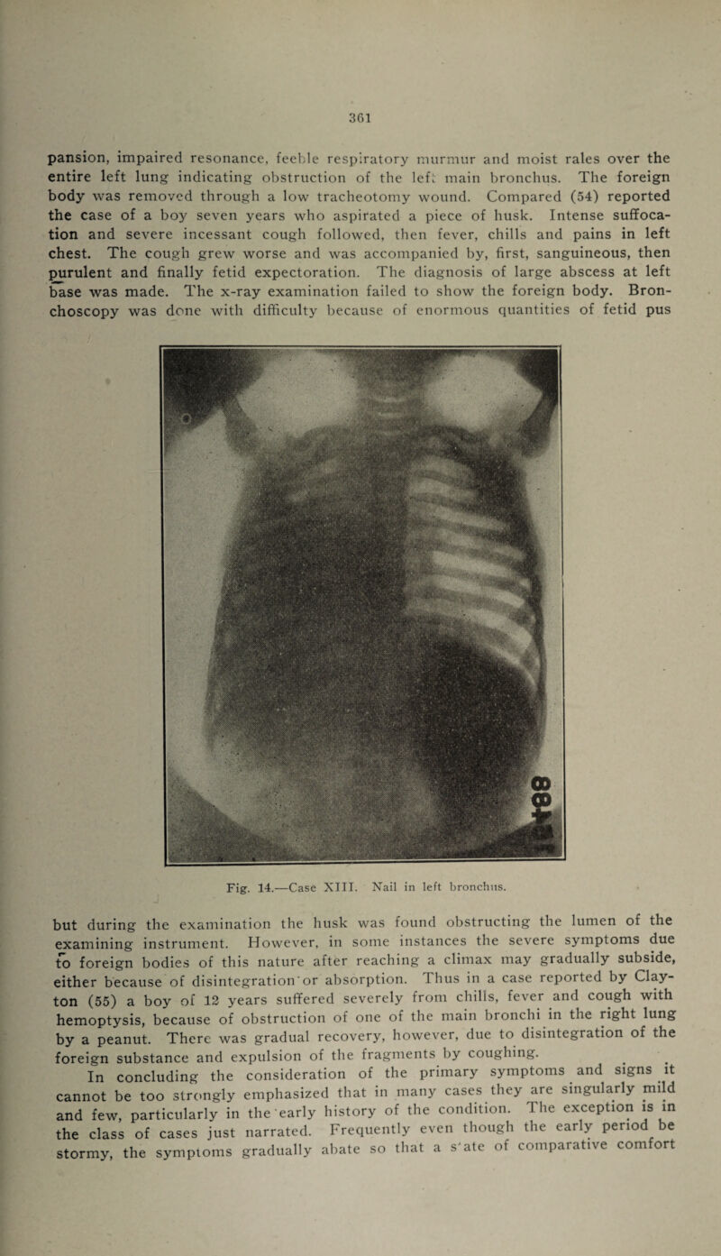 pansion, impaired resonance, feeble respiratory murmur and moist rales over the entire left lung indicating obstruction of the left main bronchus. The foreign body was removed through a low tracheotomy wound. Compared (54) reported the case of a boy seven years who aspirated a piece of husk. Intense suffoca¬ tion and severe incessant cough followed, then fever, chills and pains in left chest. The cough grew worse and was accompanied by, first, sanguineous, then purulent and finally fetid expectoration. The diagnosis of large abscess at left base was made. The x-ray examination failed to show the foreign body. Bron¬ choscopy was done with difficulty because of enormous quantities of fetid pus Fig. 14.—Case XIII. Nail in left bronchus. but during the examination the husk was found obstructing the lumen of the examining instrument. However, in some instances the severe symptoms due to foreign bodies of this nature after reaching a climax may gradually subside, either because of disintegration'or absorption. Thus in a case reported by Clay¬ ton (55) a boy of 12 years suffered severely from chills, fever and cough with hemoptysis, because of obstruction of one of the main bronchi in the right lung by a peanut. There was gradual recovery, however, due to disintegi ation of the foreign substance and expulsion of the fragments by coughing. In concluding the consideration of the primary symptoms and signs it cannot be too strongly emphasized that in many cases they are singularly mild and few, particularly in the early history of the condition. The exception is in the class of cases just narrated. Frequently even though the early period be stormy, the symptoms gradually abate so that a s'ate of comparative comfort