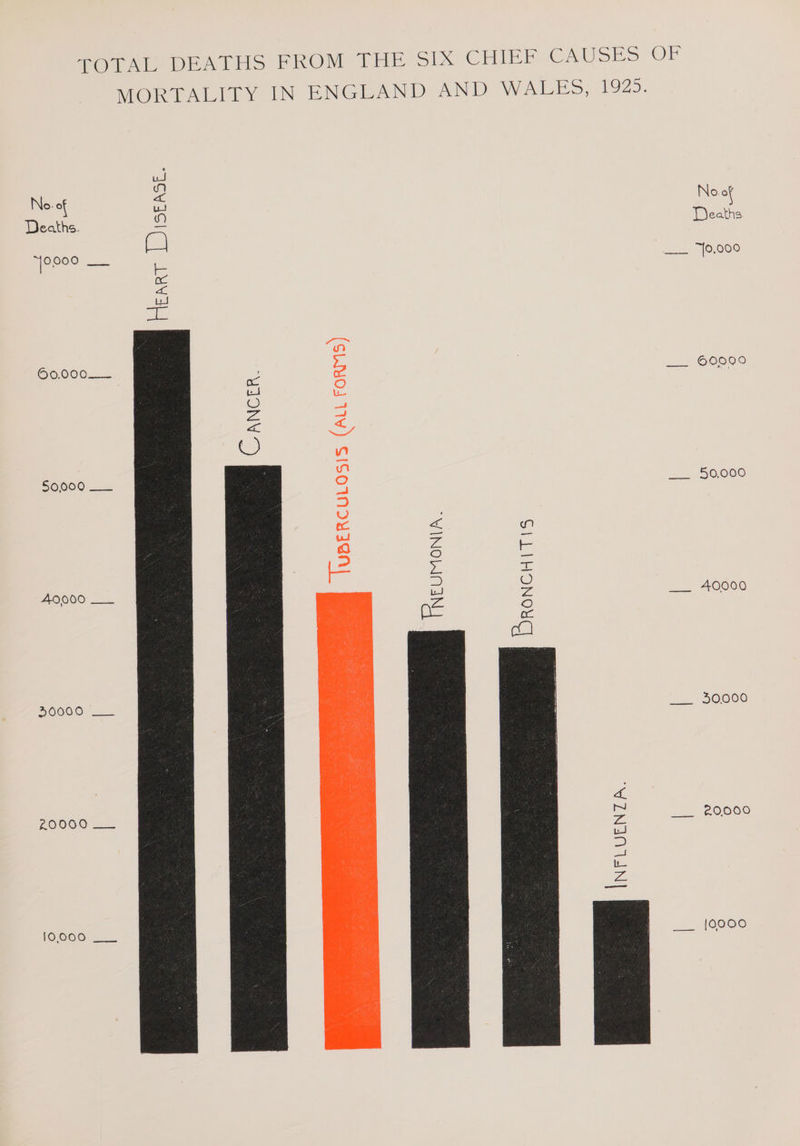 FOAL DEATHS PROM THE Six CHIEF CAUSES OF MORTALIVY IN ENGUAND AND WA IES, 1925. ue No of = No of Deaths. a Deaths “jo000 __ é =, 0,008 oc axe id ale iret fe) 60,000. bo =! SOOO oc O ut ie > 4 < = ce) A ; Tal 50000 ___ S/ 1, 56,060 3 ec < <n ul = “i 3 g FE i ys AG i) O A0000 = oa _ A0000 oho O Glee oc a) 40000 = 5OO00 ue IN 2O0G0—2 > 2 120009 ras es) sal (fb. Ves [0000 10,000