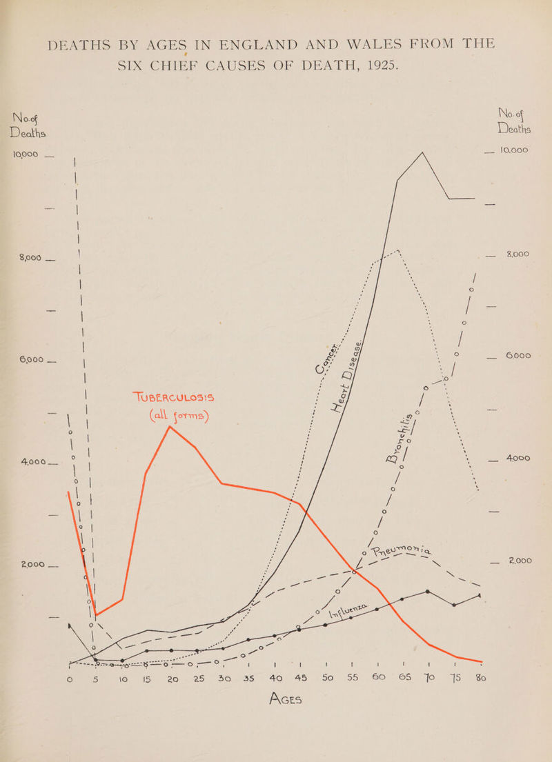 DEATHS BY AGES IN ENGLAND AND WALES FROM THE Spo Chink CAUSES OF DEATH, 1925. No.of No. of Dealhs. Deaths |O000 | x OOS | | ee ese | | | S000 | a =2 $066 | | ‘ | ry —— — | : | | e ; / | a 6000 2_ Ly s ware AOOGOw: | Cy wi | Q Se | TUBERCULOS!S oe 7 as | (all sorms) a SS R ae ts 4 | | =/ cit S 4000... ° | i ea) / __ 4000 ‘ / / ZOOO _.. a= “2008