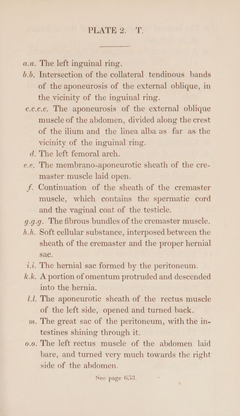 a. a. The left inguinal ring. b. b. Intersection of the collateral tendinous hands of the aponeurosis of the external oblique, in the vicinity of the inguinal ring. c. c.c.c. The aponeurosis of the external oblique muscle of the abdomen, divided along the crest of the ilium and the linea alba as far as the vicinity of the inguinal ring. d. The left femoral arch. e.e. The membrano-aponeurotic sheath of the cre¬ master muscle laid open. f. Continuation of the sheath of the cremaster muscle, which contains the spermatic cord and the vaginal coat of the testicle. g. g.g. The fibrous bundles of the cremaster muscle. h. h. Soft cellular substance, interposed between the sheath of the cremaster and the proper hernial sac. i.i. The hernial sac formed by the peritoneum. k.k. A portion of omentum protruded and descended into the hernia. /./. The aponeurotic sheath of the rectus muscle of the left side, opened and turned back, m. The great sac of the peritoneum, with the in¬ testines shining through it. o.o. The left rectus muscle of the abdomen laid bare, and turned very much towards the right side of the abdomen. Sen page f>.v>.