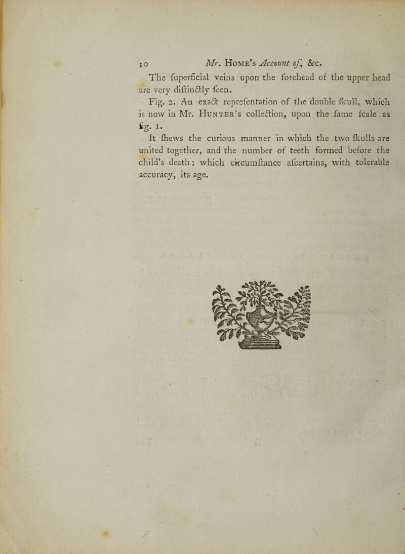 r 10 Mr, Home’s Account of^ See, The fuperficial veins upon the forehead of the upper head are very diflinflly feen. Fig. 2, An exa£l reprefentatlon of tiie double fr;ull, which is now in Mr. Hunter’s collection, upon the fame fcale as £g. I. It fhews the curious manner in which the two ilculls are united together, and the number of teeth formed before the child’s death; wdiich ckcumftance afeertains, with tolerable accuracy, its age.