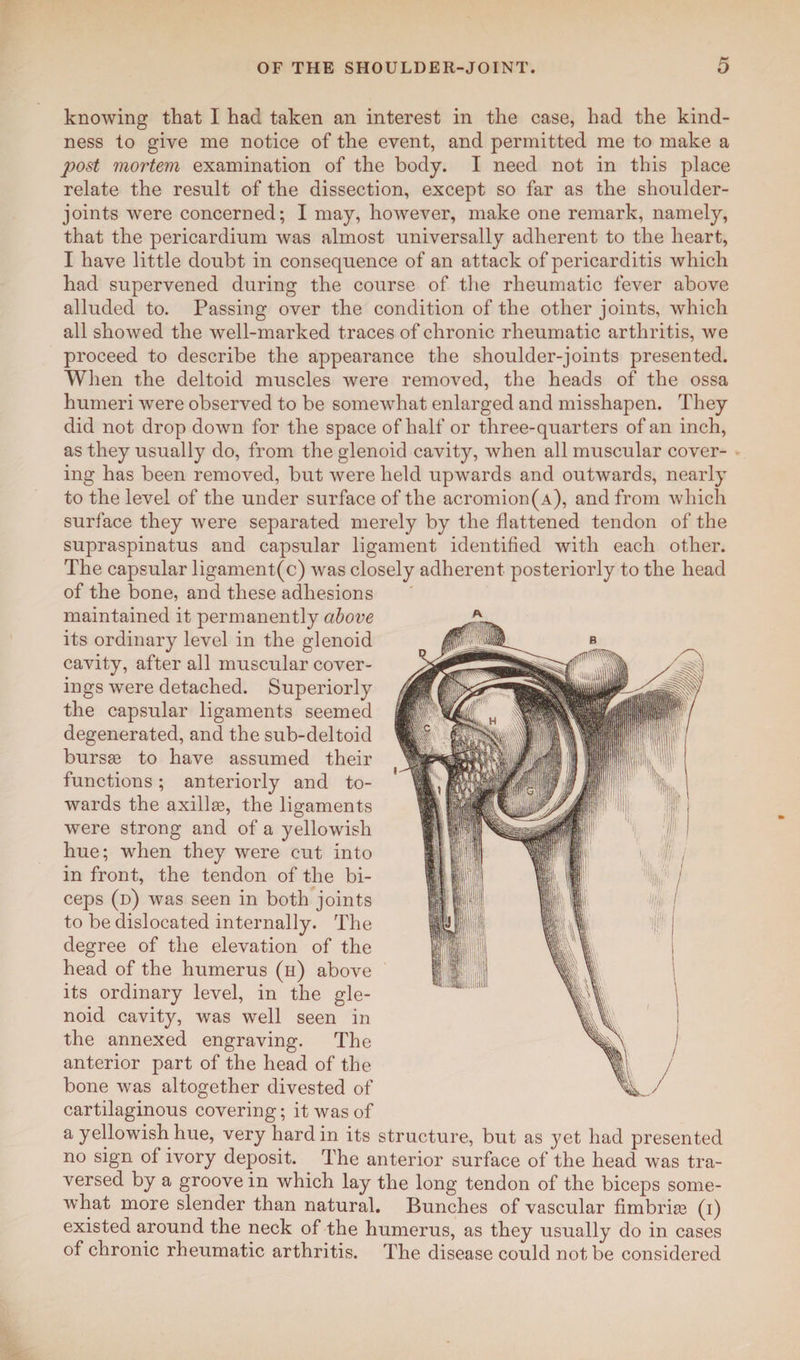 knowing that I had taken an interest in the case, had the kind¬ ness to give me notice of the event, and permitted me to make a post mortem examination of the body. I need not in this place relate the result of the dissection, except so far as the shoulder- joints were concerned; I may, however, make one remark, namely, that the pericardium was almost universally adherent to the heart, I have little doubt in consequence of an attack of pericarditis which had supervened during the course of the rheumatic fever above alluded to. Passing over the condition of the other joints, which all showed the well-marked traces of chronic rheumatic arthritis, Ave proceed to describe the appearance the shoulder-joints presented. When the deltoid muscles were removed, the heads of the ossa humeri were observed to be somewhat enlarged and misshapen. They did not drop down for the space of half or three-quarters of an inch, as they usually do, from the glenoid cavity, when all muscular cover¬ ing has been removed, but were held upwards and outwards, nearly to the level of the under surface of the acromion (a), and from which surface they wrere separated merely by the flattened tendon of the supraspinatus and capsular ligament identified with each other. The capsular ligament(c) was closely adherent posteriorly to the head of the bone, and these adhesions maintained it permanently above its ordinary level in the glenoid cavity, after all muscular cover¬ ings were detached. Superiorly the capsular ligaments seemed degenerated, and the sub-deltoid bursse to have assumed their functions; anteriorly and to¬ wards the axillae, the ligaments were strong and of a yellowish hue; when they were cut into in front, the tendon of the bi¬ ceps (d) was seen in both joints to be dislocated internally. The degree of the elevation of the head of the humerus (h) above its ordinary level, in the gle¬ noid cavity, was well seen in the annexed engraving. The anterior part of the head of the bone was altogether divested of cartilaginous covering; it was of a yellowish hue, very hard in its structure, but as yet had presented no sign of ivory deposit. The anterior surface of the head was tra¬ versed by a groove in which lay the long tendon of the biceps some¬ what more slender than natural. Bunches of vascular fimbria3 (i) existed around the neck of the humerus, as they usually do in cases of chronic rheumatic arthritis. The disease could not be considered
