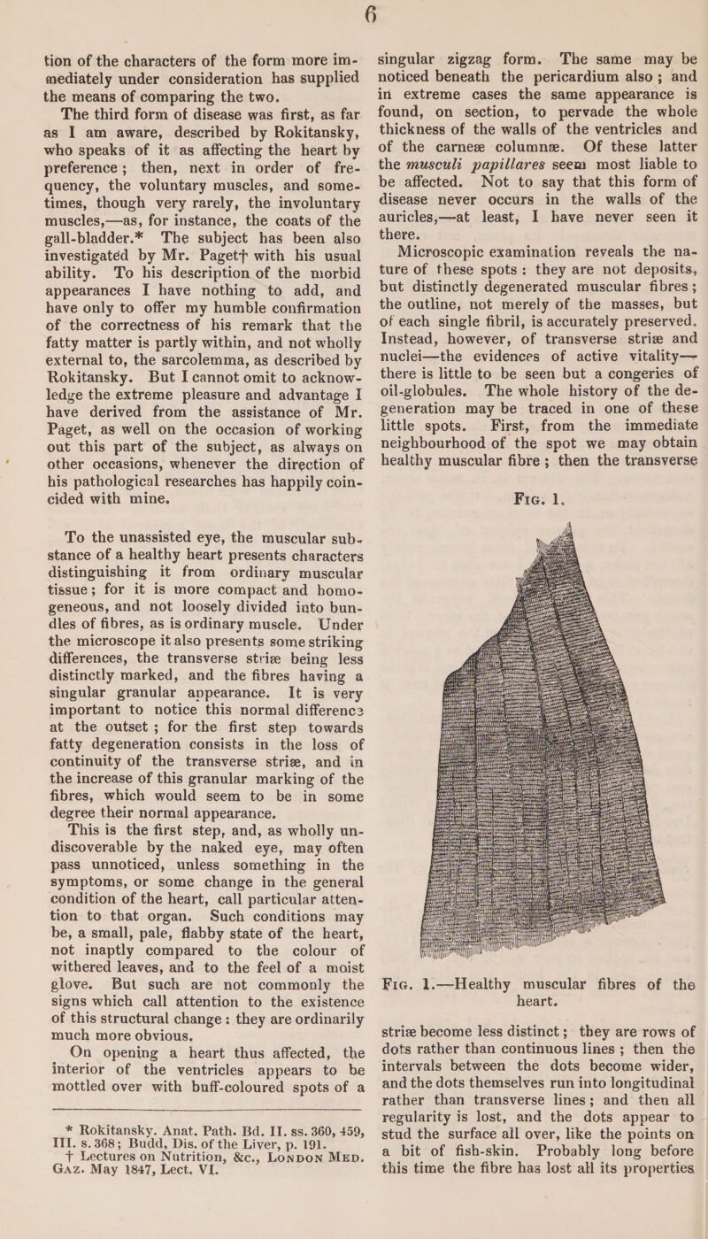 tion of the characters of the form more im¬ mediately under consideration has supplied the means of comparing the two. The third form of disease was first, as far as I am aware, described by Rokitansky, who speaks of it as affecting the heart bv preference; then, next in order of fre¬ quency, the voluntary muscles, and some¬ times, though very rarely, the involuntary muscles,—as, for instance, the coats of the gall-bladder.* The subject has been also investigated by Mr. Pagetf with his usual ability. To his description of the morbid appearances I have nothing to add, and have only to offer my humble confirmation of the correctness of his remark that the fatty matter is partly within, and not wholly external to, the sarcolemma, as described by Rokitansky. But I cannot omit to acknow¬ ledge the extreme pleasure and advantage I have derived from the assistance of Mr. Paget, as well on the occasion of working out this part of the subject, as always on other occasions, whenever the direction of his pathological researches has happily coin¬ cided with mine. To the unassisted eye, the muscular sub¬ stance of a healthy heart presents characters distinguishing it from ordinary muscular tissue; for it is more compact and homo¬ geneous, and not loosely divided into bun¬ dles of fibres, as is ordinary muscle. Under the microscope it also presents some striking differences, the transverse striae being less distinctly marked, and the fibres having a singular granular appearance. It is very important to notice this normal difference at the outset ; for the first step towards fatty degeneration consists in the loss of continuity of the transverse striae, and in the increase of this granular marking of the fibres, which would seem to be in some degree their normal appearance. This is the first step, and, as wholly un- discoverable by the naked eye, may often pass unnoticed, unless something in the symptoms, or some change in the general condition of the heart, call particular atten¬ tion to that organ. Such conditions may be, a small, pale, flabby state of the heart, not inaptly compared to the colour of withered leaves, and to the feel of a moist glove. But such are not commonly the signs which call attention to the existence of this structural change : they are ordinarily much more obvious. On opening a heart thus affected, the interior of the ventricles appears to he mottled over with buff-coloured spots of a * Rokitansky. Anat. Path. Bd. II. ss. 360, 459, III. s. 368; Budd, Dis. of the Liver, p. 191. t Lectures on Nutrition, &c., London Med. Gaz. May 1847, Lect. VI. singular zigzag form. The same may be noticed beneath the pericardium also ; and in extreme cases the same appearance is found, on section, to pervade the whole thickness of the walls of the ventricles and of the carneae columnae. Of these latter the musculi papillares seem most liable to be affected. Not to say that this form of disease never occurs in the walls of the auricles,—at least, I have never seen it there. Microscopic examination reveals the na¬ ture of these spots : they are not deposits, but distinctly degenerated muscular fibres; the outline, not merely of the masses, but of each single fibril, is accurately preserved. Instead, however, of transverse striae and nuclei—the evidences of active vitality— there is little to be seen but a congeries of oil-globules. The whole history of the de¬ generation may be traced in one of these little spots. First, from the immediate neighbourhood of the spot we may obtain healthy muscular fibre ; then the transverse Fig. 1, Fig. X.—Healthy muscular fibres of the heart. striae become less distinct; they are rows of dots rather than continuous lines ; then the intervals between the dots become wider, and the dots themselves run into longitudinal rather than transverse lines ; and then all regularity is lost, and the dots appear to stud the surface all over, like the points on a bit of fish-skin. Probably long before this time the fibre has lost all its properties