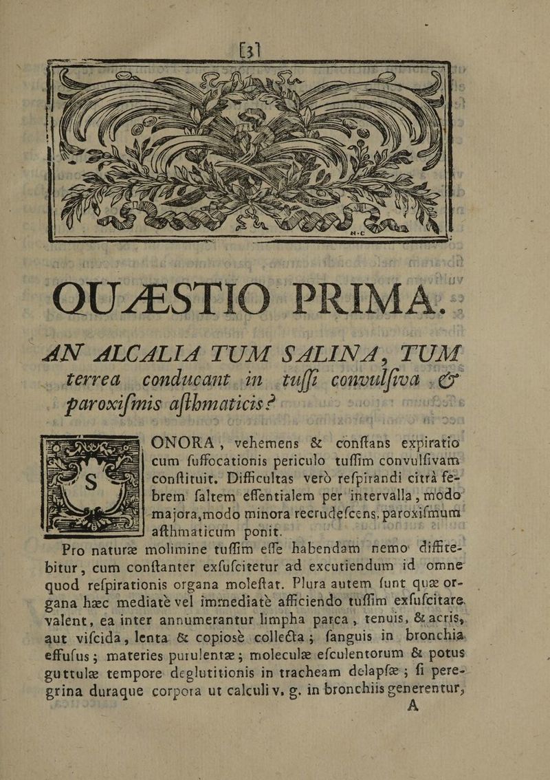 AN ALCALIA TUM SALINA, TUM . Kerrea . conducant. in. tu[J]. comoul[roa . e garoxifmis aftbmaticis? i» sdoiret mindfagt . ONORA , vehemens &amp; conftans expiratio cum fuffocationis periculo tuffim convulfivam conflituit, Difficultas vero refpirandi citrà fe- Jlg3| brem: faltem effentialem per intervalla , modo zu -majora,modo minora recrudefcens, paroxifmum: 2j afthmaticum ponit. | | acies Pro nature molimine tuffim effe habendam nemo diffite- bitur, cum conftanter exfufcitetur ad excutiendum id omne quod refpirationis organa moleftat. Plura autem funt qua or- gana hzc mediate vel imrznediat? afficiendo tuffim exfufcitare. valent, ea inter annumerantur limpha parca , tenuis, &amp; acris; aut vifcida, lenta. &amp; copioss collecta ;. fanguis in. bronchia. effufus ; materies purulentz ; molecule efculentorum &amp; potus guttule tempore deglutitionis in tracheam dclapfe ; fi pere-- grina duraque corpora ut calculi v, g. in bronchiis generentur,