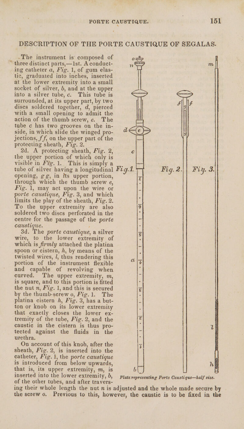 DESCRIPTION OF THE PORTE CAUSTIQUE OF SEGALAS. The instrument is' composed of three distinct parts,—1st. A conduct¬ ing catheter a, Fig. 1, of gum elas¬ tic, graduated into inches, inserted at the lower extremity into a small socket of silver, b, and at the upper into a silver tube, c. This tube is surrounded, at its upper part, by two discs soldered together, d, pierced with a small opening to admit the action of the thumb screw, e. The tube c has two grooves on the in¬ side, in which slide the winged pro¬ jections,//, on the upper part of the protecting sheath, Fig. 2. 2d. A protecting sheath, Fig. 2, the upper portion of which only is visible in Fig. 1. This is simply a tube of silver having a longitudinal opening, gg, in fts upper portion, through which the thumb screw e, Fig. 1, may act upon the wire or 'porte caustique, Fig. 3, and which limits the play of the sheath, Fig. 2. To the upper extremity are also soldered two discs perforated in the centre for the passage of the porte caustique. 3d. The porte caustique, a silver wire, to the lower extremity of which is firmly attached the platina spoon or cistern, A, by means of the twisted wires, l, thus rendering this portion of the instrument flexible and capable of revolving when curved. The upper extremity, to, is square, and to this portion is fitted the nut ft, Fig. 1, and this is secured by the thumb-screw o, Fig. 1. The platina cistern h, Fig. 3, has a but¬ ton or knob on its lower extremity that exactly closes the lower ex¬ tremity of the tube, Fig. 2, and the caustic in the cistern is thus pro¬ tected against the fluids in the urethra. On account of this knob, after the sheath, Fig. 2, is inserted into the catheter, Fig. 1, the porte caustique is introduced from below upwards, that is, its upper extremity, to, is inserted into the lower extremity, b, of the other tubes, and after travers- m ^jinuinnirnimiifr /- ftiiiimiiiiniiuuniup Æï/ IlCf 1. a Fic).2. h Plate representing Ports Caustique—half size. Fiy. 3. i --- - ing their whole length the nut n is adjusted and the whole made secure by the screw o. Previous to this, however, the caustic is to be fixed in the