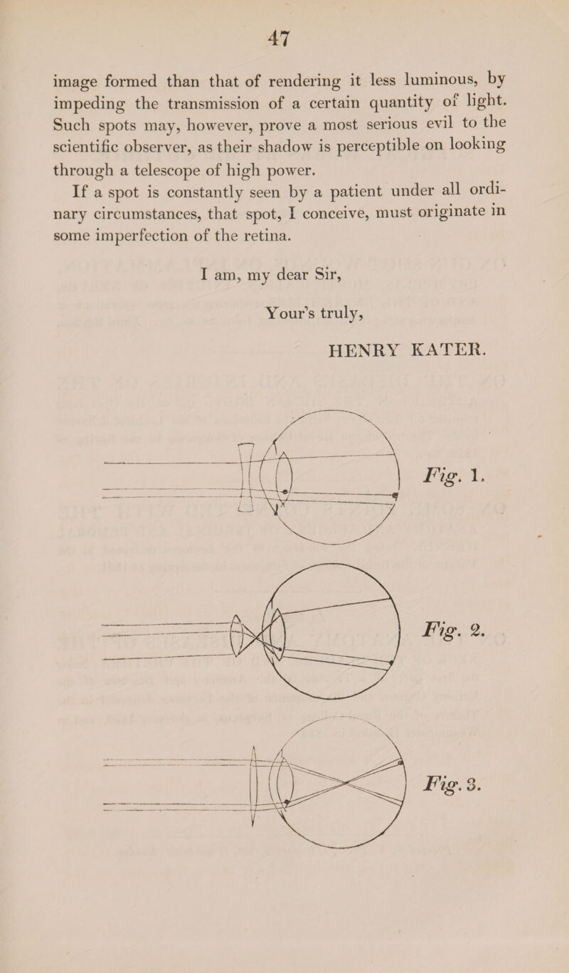 image formed than that of rendering it less luminous, by impeding the transmission of a certain quantity of light. Such spots may, however, prove a most serious evil to the scientific observer, as their shadow is perceptible on looking through a telescope of high power. If a spot is constantly seen by a patient under all ordi¬ nary circumstances, that spot, I conceive, must originate in some imperfection of the retina. I am, my dear Sir, Your's truly, HENRY KATER.