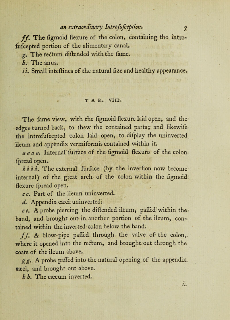 ff The figmoid flexure of the colon, containing the intro- fufcepted portion of the alimentary canal. g. The redtum diflended with the fame. h. The anus. iu Small inteftines of the natural fize and healthy appearance. TAB. VIII.- The fame view, with the figmoid flexure laid open, and the edges turned back, to fhew the contained parts; and likewife the introfufcepted colon laid open, to difplay the uninverted ileum and appendix vermiformis contained within it. aaaa. Internal'furface of the figmoid flexure of the colon; fpread open. bbbb. The external furface (by the inverfion now become internal) of the great arch of the colon within the figmoid flexure fpread open. cc. Part of the ileum uninverted. d. Appendix caeci uninverted; e e, A probe piercing the diflended ileum* pafled within the band, and brought out in another portion of the ileum, con¬ tained within the inverted colon below the band. ff A blow-pipe pafled through; the valve of the colon,, where it opened into the redtum, and brought out through the coats of the ileum above.. gg. A probe pafled into the natural opening of the appendix caeci, and brought out above. h h. The caecum inverted..