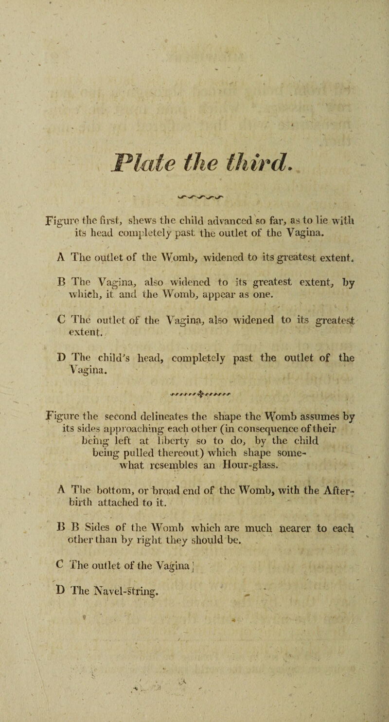 4 Plate the third. Figure the first, shews the child advanced so far, as to lie with its head completely past the outlet of the Vagina. / A The outlet of the Womb, widened to its greatest extent. B The Vagina, also widened to its greatest extent, by which, it and the Womb, appear as one. - ✓ ’ V C The outlet of the Vagina, also widened to its greatest extent. D The child's head, completely past the outlet of the Vagina. Figure the second delineates the shape the Womb assumes by its sides approaching each other (in consequence of their being left at liberty so to do, by the child being pulled thereout) which shape some¬ what resembles an Hour-glass. A The bottom, or bi’Qad end of the Womb, with the After¬ birth attached to it. B B Sides of the Womb which are much nearer to each other than by right they should be. C The outlet of the Vagina ) D The Navel-string. „ '