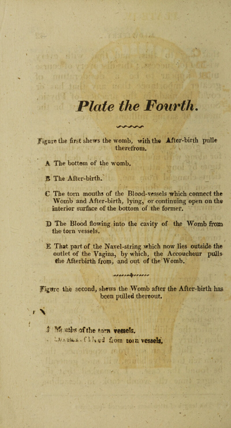 ' - r • \ / A ) \ i Plate the Fourth. Figure the first shews the womb, with the After-birth pulle therefrom. * % '  ’ / » A The bottom of the womb. B The After-birth. A ». \ j \ ' C The torn mouths of the Blood-vessels which connect the Womb and After-birth, lying, or continuing open on the interior surface of the bottom of the former. J> The Blood flowing into the cavity of the Womb from the torn vessels. \ - v r ) r‘ * / E That part of the Navel-string which now lies outside the outlet of the Vagina, by which, the Accoucheur pulls $he Afterbirth from, and out of the Womb. Figure the second, shews the Womb after the After-birth has been pulled thereout. r \ 1’ aths of the torn vessels, * N * f !*■ j SW j ' 4 . l&x . f i h icd f*om torn vessels.