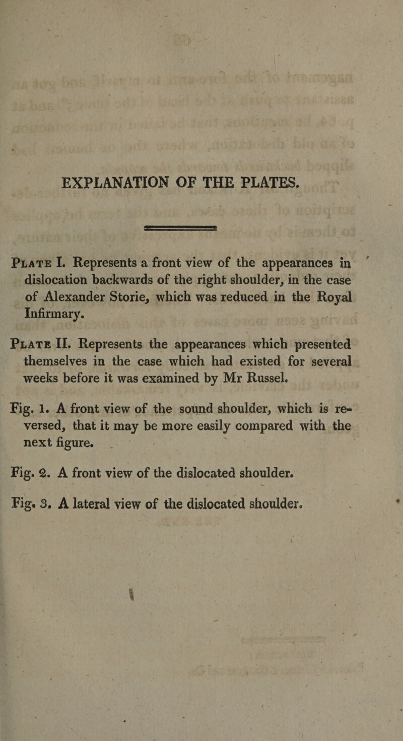 EXPLANATION OF THE PLATES. Plate I. Represents a front view of the appearances in dislocation backwards of the right shoulder, in the case of Alexander Storie, which was reduced in the Royal Infirmary. Plate II. Represents the appearances which presented themselves in the case which had existed for several weeks before it was examined by Mr Russel. Fig. 1. A front view of the sound shoulder, which is re¬ versed, that it may be more easily compared with the next figure. Fig. 2. A front view of the dislocated shoulder. Fig# 3. A lateral view of the dislocated shoulder. N i