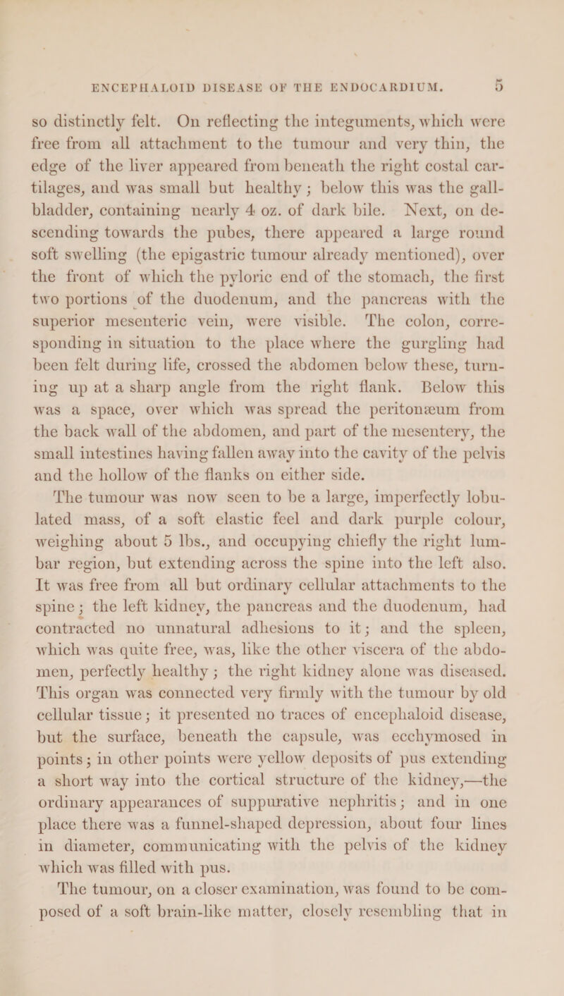 so distinctly felt. On reflecting the integuments, which were free from all attachment to the tumour and very thin, the edge of the liver appeared from beneath the right costal car¬ tilages, and wras small but healthy; below this was the gall¬ bladder, containing nearly 4 oz. of dark bile. Next, on de¬ scending towards the pubes, there appeared a large round soft swelling (the epigastric tumour already mentioned), over the front of which the pyloric end of the stomach, the first two portions of the duodenum, and the pancreas with the superior mesenteric vein, were visible. The colon, corre¬ sponding in situation to the place where the gurgling had been felt during life, crossed the abdomen below these, turn¬ ing up at a sharp angle from the right flank. Below this was a space, over which was spread the peritomeum from the back wall of the abdomen, and part of the mesentery, the small intestines having fallen away into the cavity of the pelvis and the hollow of the flanks on either side. The tumour was now seen to be a large, imperfectly lobu- lated mass, of a soft elastic feel and dark purple colour, weighing about 5 lbs., and occupying chiefly the right lum¬ bar region, but extending across the spine into the left also. It was free from all but ordinary cellular attachments to the spine; the left kidney, the pancreas and the duodenum, had contracted no unnatural adhesions to it; and the spleen, which was quite free, was, like the other viscera of the abdo¬ men, perfectly healthy; the right kidney alone was diseased. This organ was connected very firmly with the tumour by old cellular tissue; it presented no traces of enceplialoid disease, but the surface, beneath the capsule, was ecchymosed in points; in other points were yellow deposits of pus extending a short way into the cortical structure of the kidney,—the ordinary appearances of suppurative nephritis; and in one place there was a funnel-shaped depression, about four lines in diameter, communicating with the pelvis of the kidney which was filled with pus. The tumour, on a closer examination, was found to be com¬ posed of a soft brain-like matter, closely resembling that in