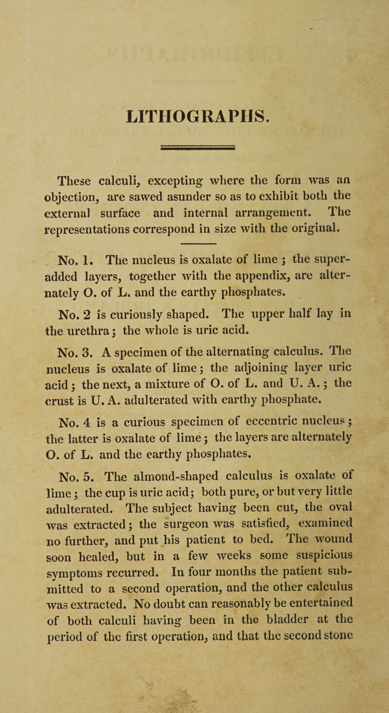 These calculi, excepting where the form was an objection, are sawed asunder so as to exhibit both the external surface and internal arrangement. The representations correspond in size with the original. No. 1. The nucleus is oxalate of lime ; the super- added layers, together with the appendix, are alter¬ nately O. of L. and the earthy phosphates. No. 2 is curiously shaped. The upper half lay in the urethra; the whole is uric acid. No. 3. A specimen of the alternating calculus. The nucleus is oxalate of lime; the adjoining layer uric acid; the next, a mixture of O. of L. and U. A. 5 the crust is U. A. adulterated with earthy phosphate. No. 4 is a curious specimen of eccentric nucleus; the latter is oxalate of lime; the layers are alternately O. of L. and the earthy phosphates. No. 5. The almond-shaped calculus is oxalate of lime ; the cup is uric acid; both pure, or but very little adulterated. The subject having been cut, the oval was extracted; the surgeon was satisfied, examined no further, and put his patient to bed. The wound soon healed, but in a few weeks some suspicious symptoms recurred. In four months the patient sub¬ mitted to a second operation, and the other calculus was extracted. No doubt can reasonably be entertained of both calculi having been in the bladder at the period of the first operation, and that the second stone