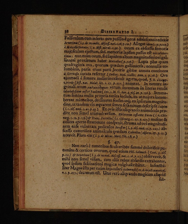 'ellicalum cuminferto ovo pufilloé gena adolefcentis eduxit Serrinu (L2. de recondit, Abeeff. natzcaé, pira.) Allegat.idem(..y; pto1.) £ Mateelle Donato ( L4. Hift: mirab.c:3o.: ovum ex abfceffu femoris majüfculum eje&amp;um, fed. memoriz lapfüm paffus eft virceteber- rin»; non enim oyum, fedlapidemalbum magnitudiniovi gal. linacei: proximum: habct: Marceliu( p. 524.) Lupia plus qvam - qvadraginta ova , qvorum qvzdam gallinaceis ; nonnulla co» lumbinis, paria. erant parti Jecoris gibbe annata continens é.Getntafio curata refertur. ( Zodiac. Med. Gallig; Ann, y. P256.) Qva ejusmedi &amp; femore mulieris exfecuit àgyrta, qvod, 3. B. ZLagp- s werde (if. nat. Molat, Ut. 6. 25. p.277.) annotat.; In tumore in- gvinali. oyum uaAzxédseuov verum. inventum in literas retulit laboriofisfirus toftet Pauli us ( Dec.t..M. C. Ann, g; obf. 0. p. 136.). . Struma- berent miroribus, declinante fenfim usd; eo. ipforum magnitu- dine, ut tandem vix eqvarent femen fe faminum defcripfit rupiws (Lt. obf, mid. c, 2. p.93.),. Ex ovis iftisaliqvando animalcula pro- dire, non femel animadverfüm. | pjiloxenu; teflante Parto (1.6. Chi- 1HIg« C. 19. p. 1589) € Franc. Peccetio ( L,r. Chirurg. 6s 25. p. 127.) mufcas &amp; culices aperto fteatomate confpexit, ftruma ad ovi magnitudi- nem enfe vulnerata. pediculos Foreff ws (4. g- obf. sed. 15. D. 245.) ab- fceffu cauterifato animalcula qvzdam Cabrolius( ced 27 17; ) notavit. Plura aliji (.1. 5. de Mirac. Mart. Tit. 1.6.2. ) Padi ings j VA . $. 4h ; ; Non-raro e tumoribus &amp; ulceribus fumme dolorificis pu- tamina &amp; cortices ovorum, qvod etiam pil. Salmutb. ( Cent. 5. obf. pez. ) &amp; Severini ( l. 3. de recond., Ab[ceff. mat. c. 16. p.u s.) obfervavit &amp; mihi non femel vifum, cum aliis rebus abfurdis extrahuntur qo ipfum faícinationi magica vulgó afcribitur.- bilesabn: iter Ma gos 1fta per cutim in Jaculari Helmonti ( tr. d. in Ject material, 92. P427.) decretum eft, Utut vero aliqvando magicum aligvid fub- m fibi modo ( «i. Qj (4 Ginny M At [chi fuum dini &amp;gi tont nia eam ut (i Je (ilb Qua teni tos dia arti the LA fati bath Mi]: fug CR Jii